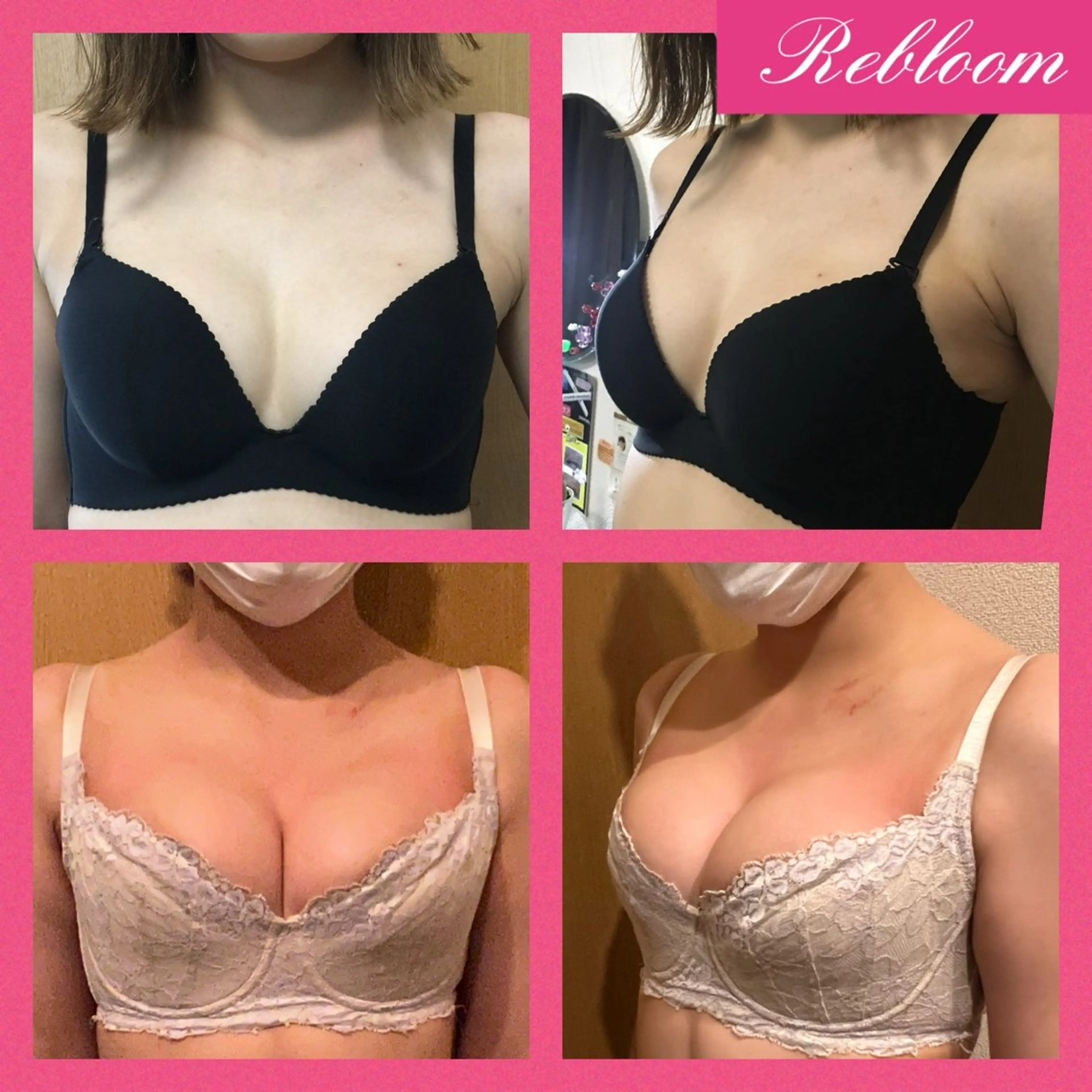 エステ デリケートな悩み解決 Rebloomのエステ・リラクイメージ