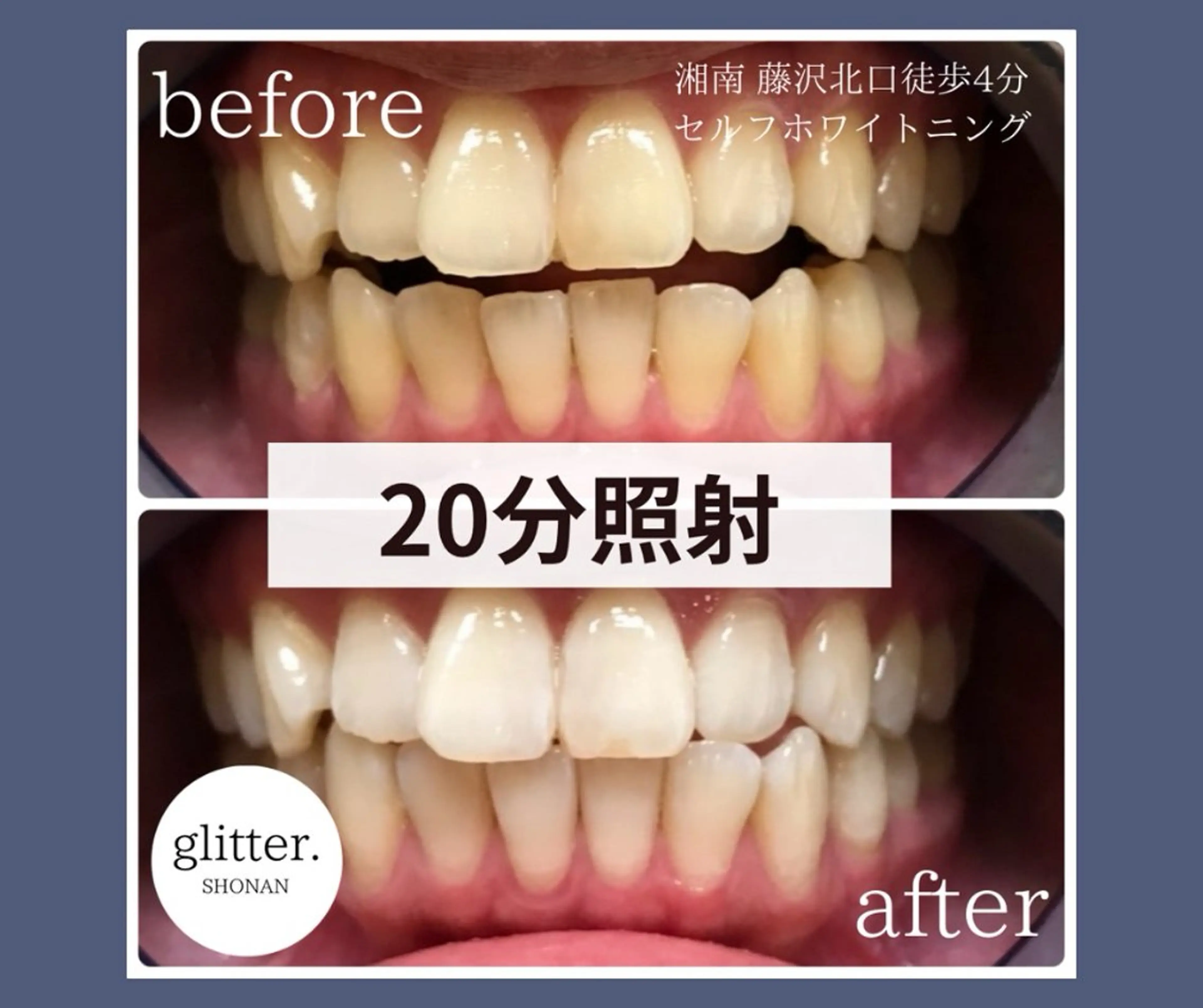 マツエク・マツパ glitter.SHONAN所属・ホワイトニング専門店 glitterのその他イメージ