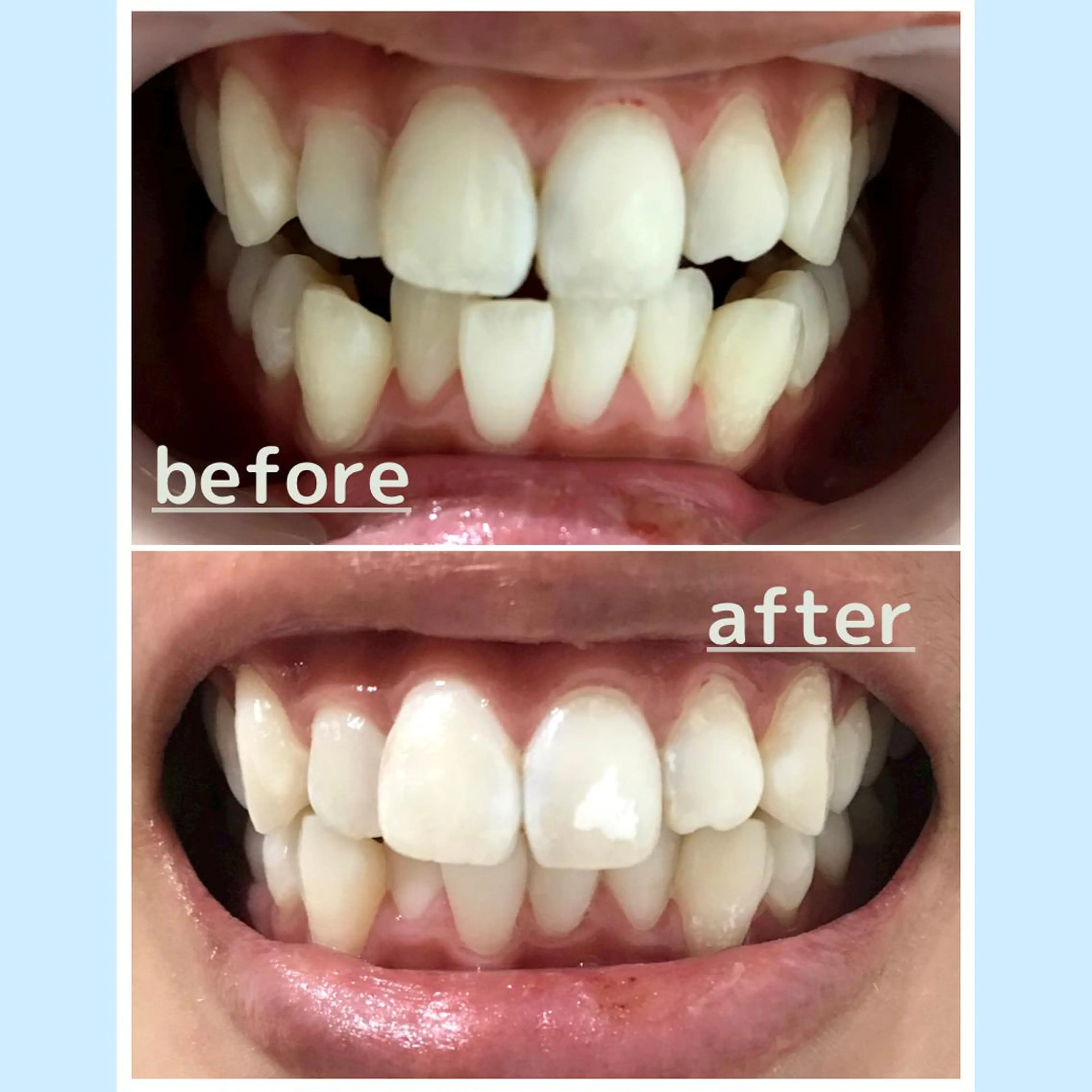 お手軽ホワイトニングsalon mina所属・武元 奈津美のその他イメージ