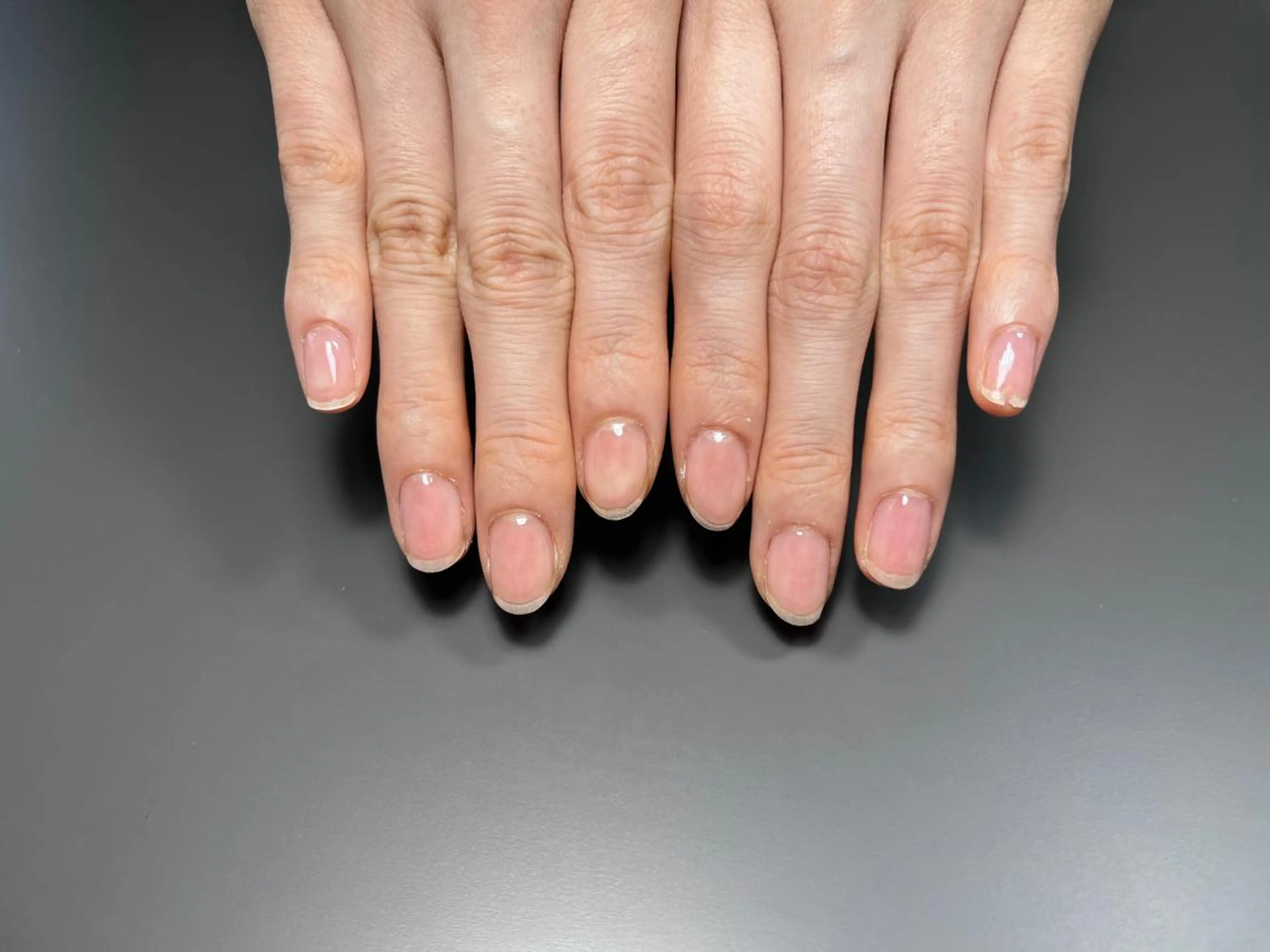 🌵ケアのみ🌵の写真