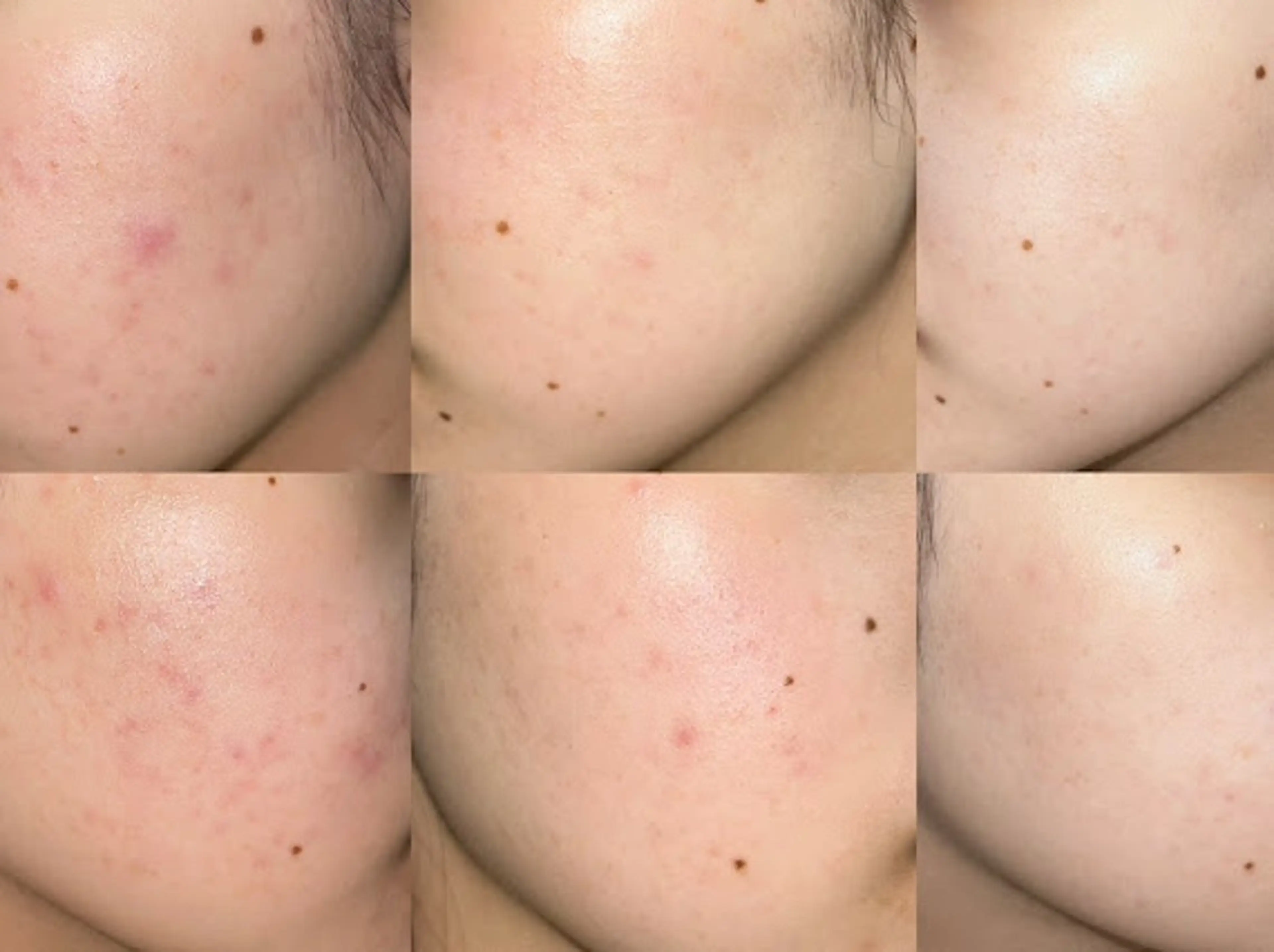 韓国肌管理Belle 桜木町所属・韓国肌管理Belle 桜木町のエステ・リラクイメージ