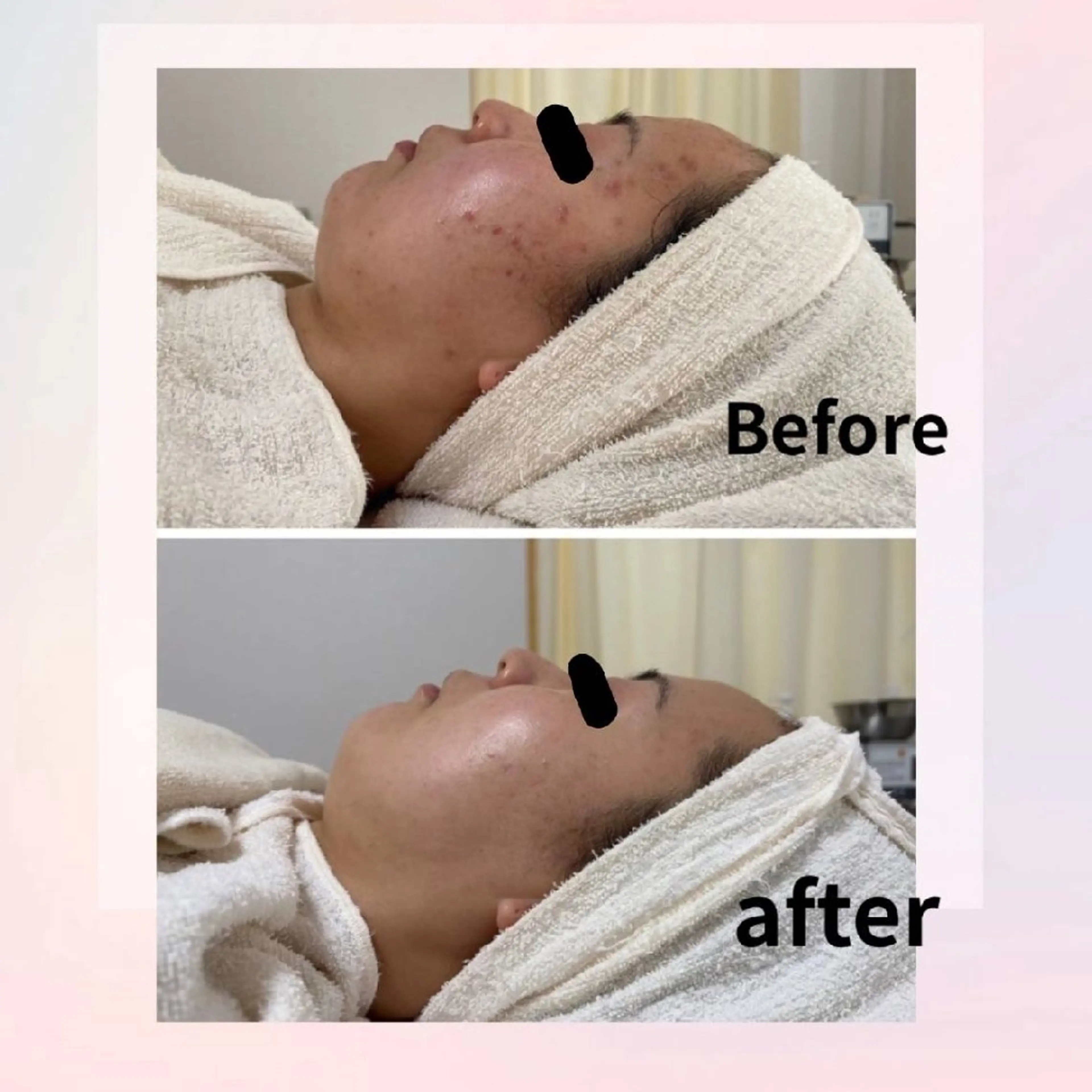 エステ ニキビケア＆ニキビ跡 レゾン京橋店　のエステ・リラクイメージ