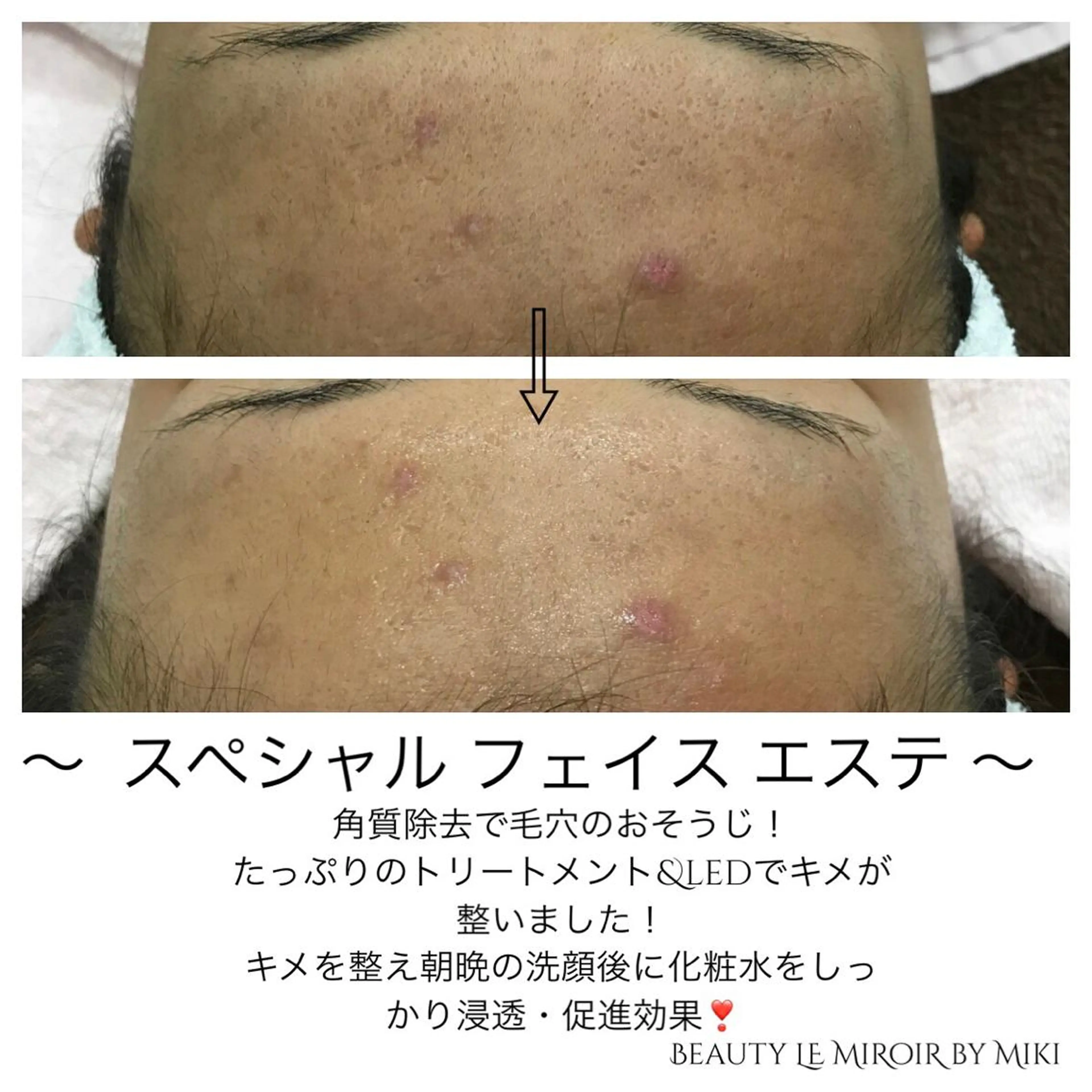 ビューティー ミロワールのエステ・リラクイメージ