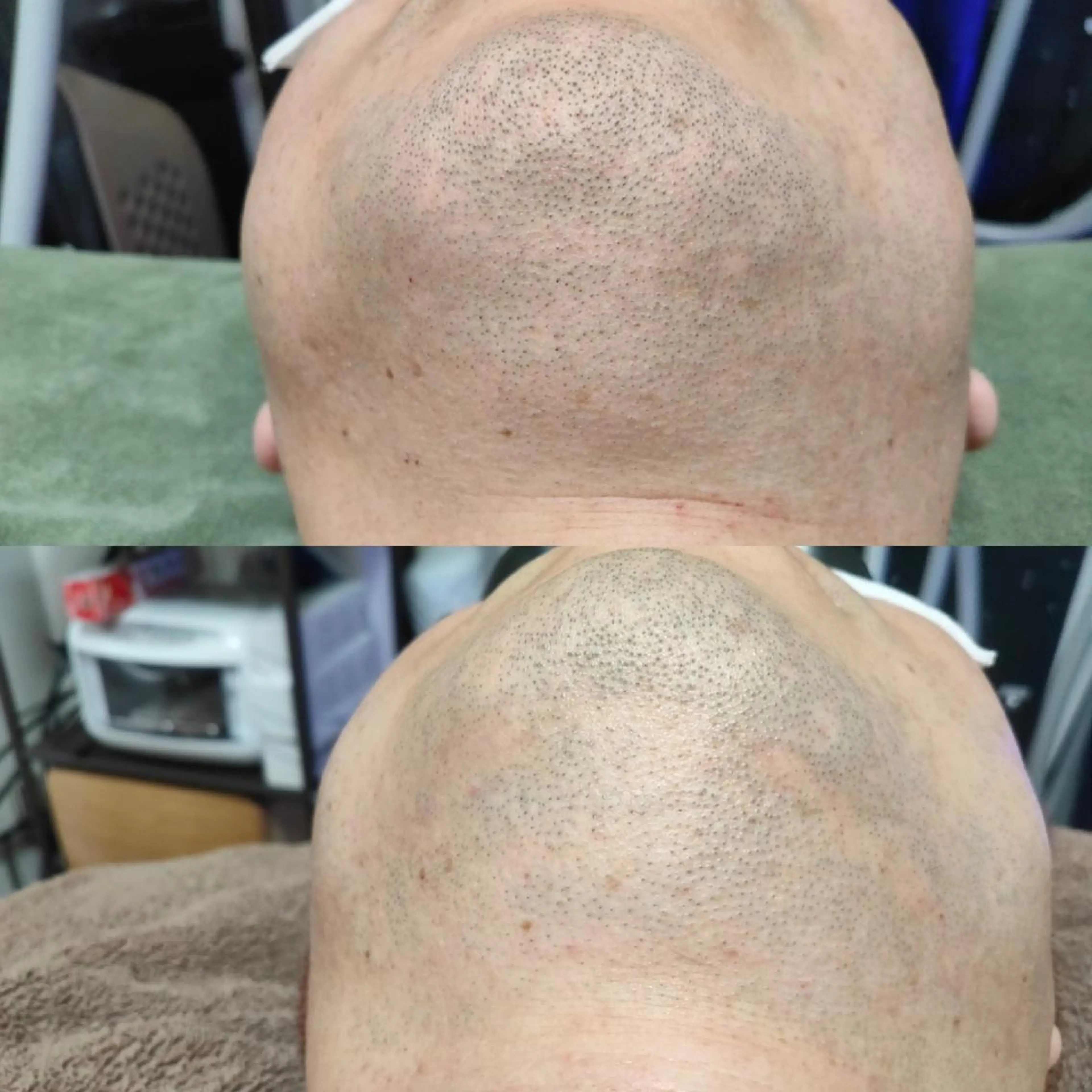 メンズ 武 藤のエステ・リラクイメージ