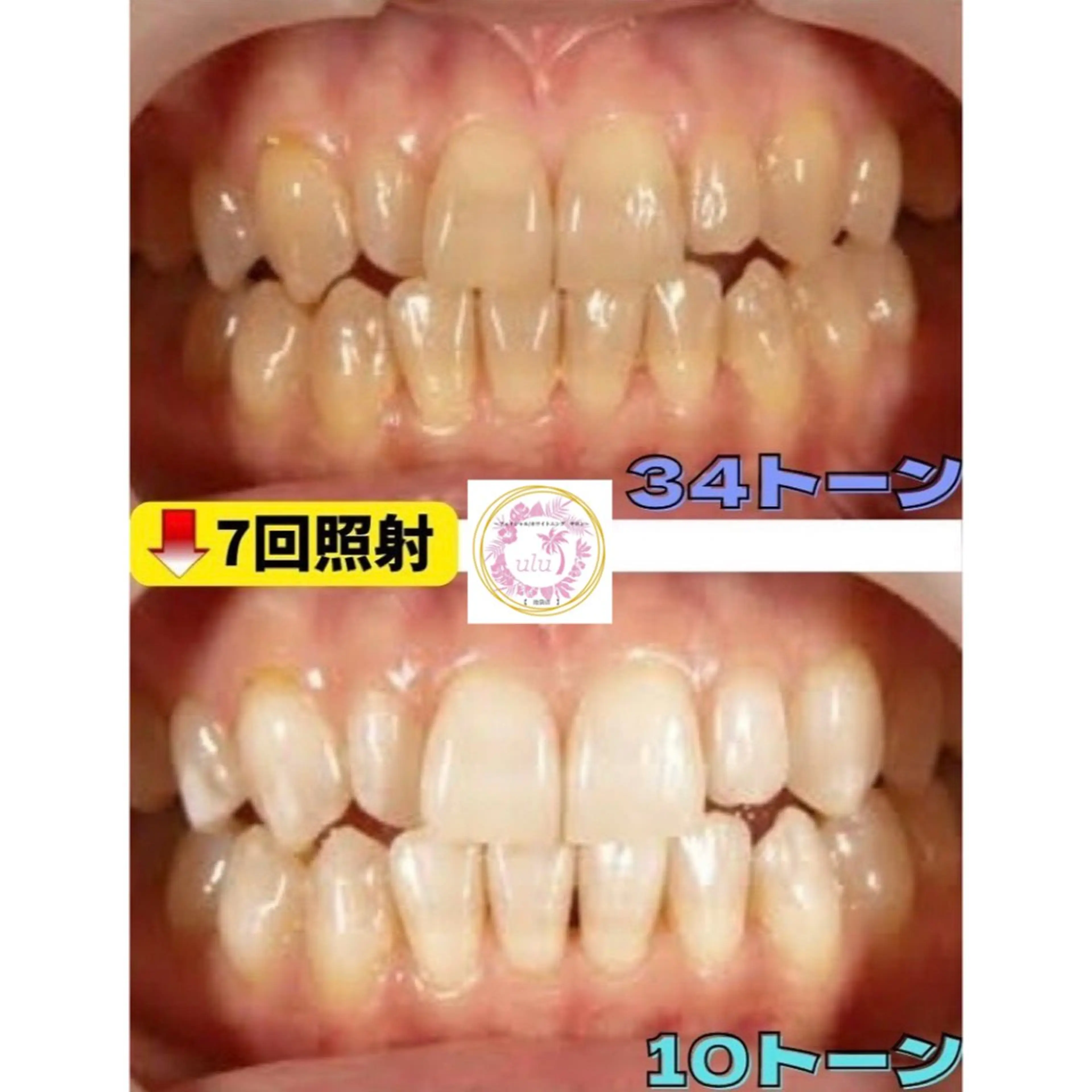 セルフホワイトニング サロンulu池袋のその他イメージ