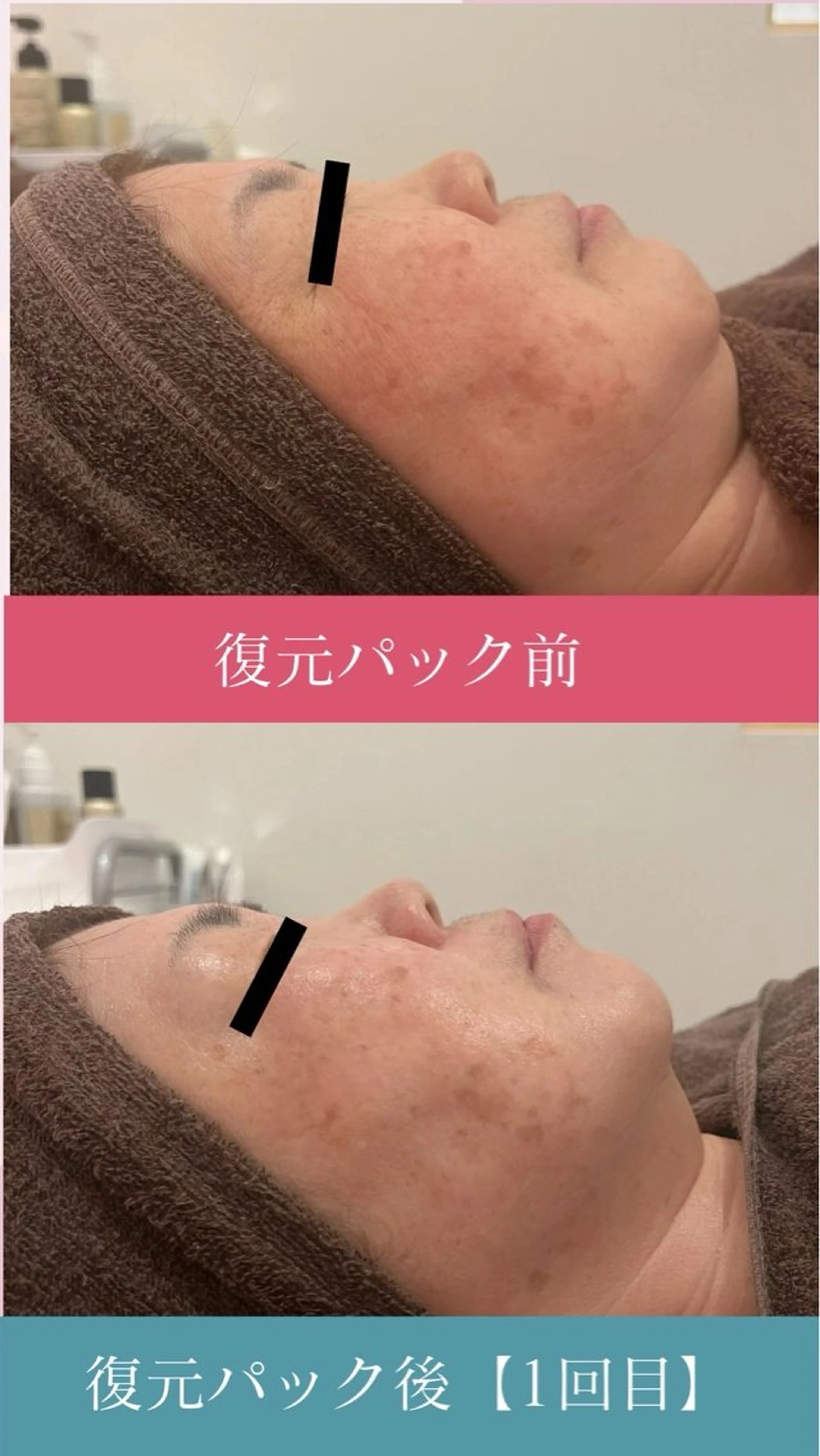 エステ Cheerful所属・痩身＆身体改善専門 Cheerfulのエステ・リラクイメージ