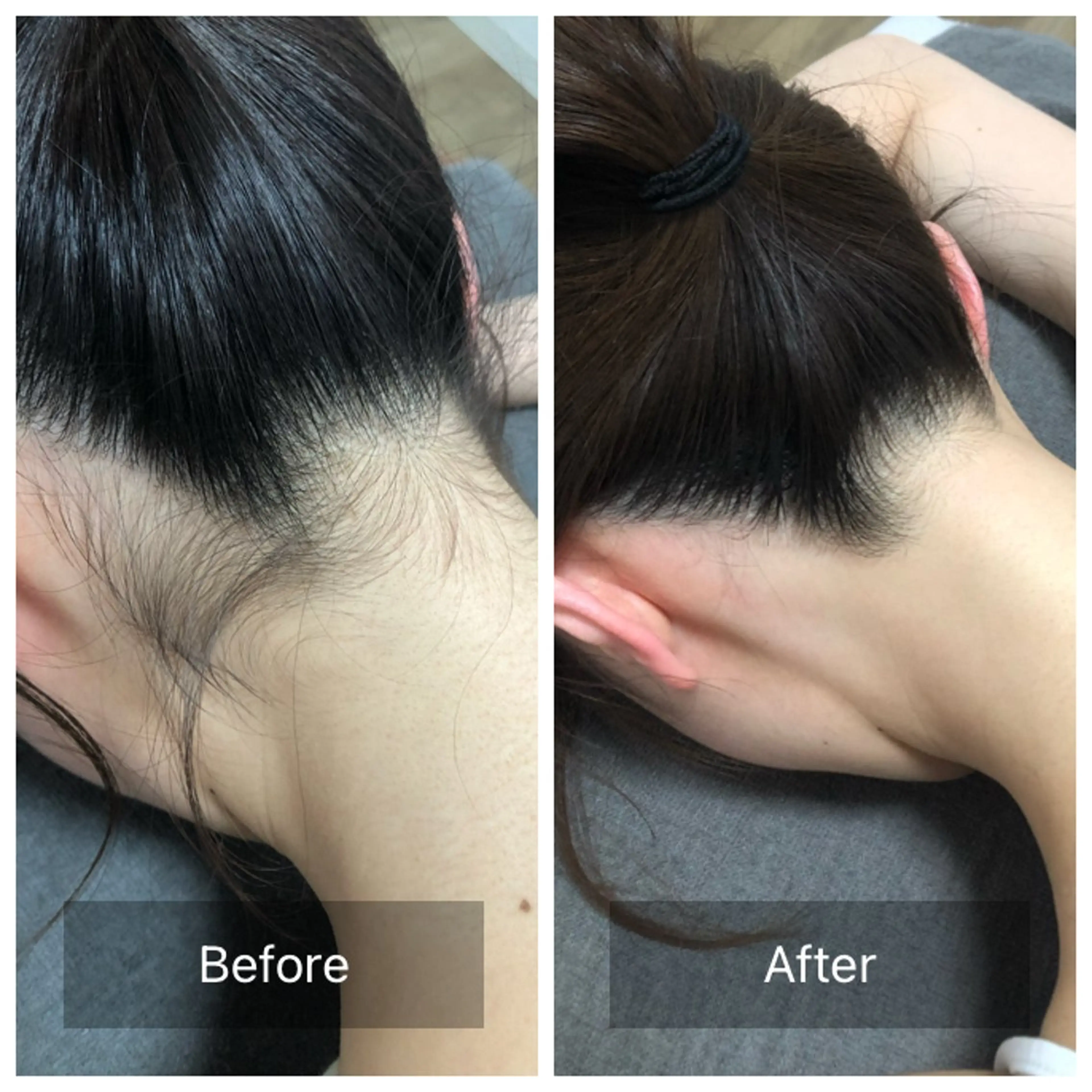 脱毛 Lumiere despoir所属・Lumiere despoirのエステ・リラクイメージ