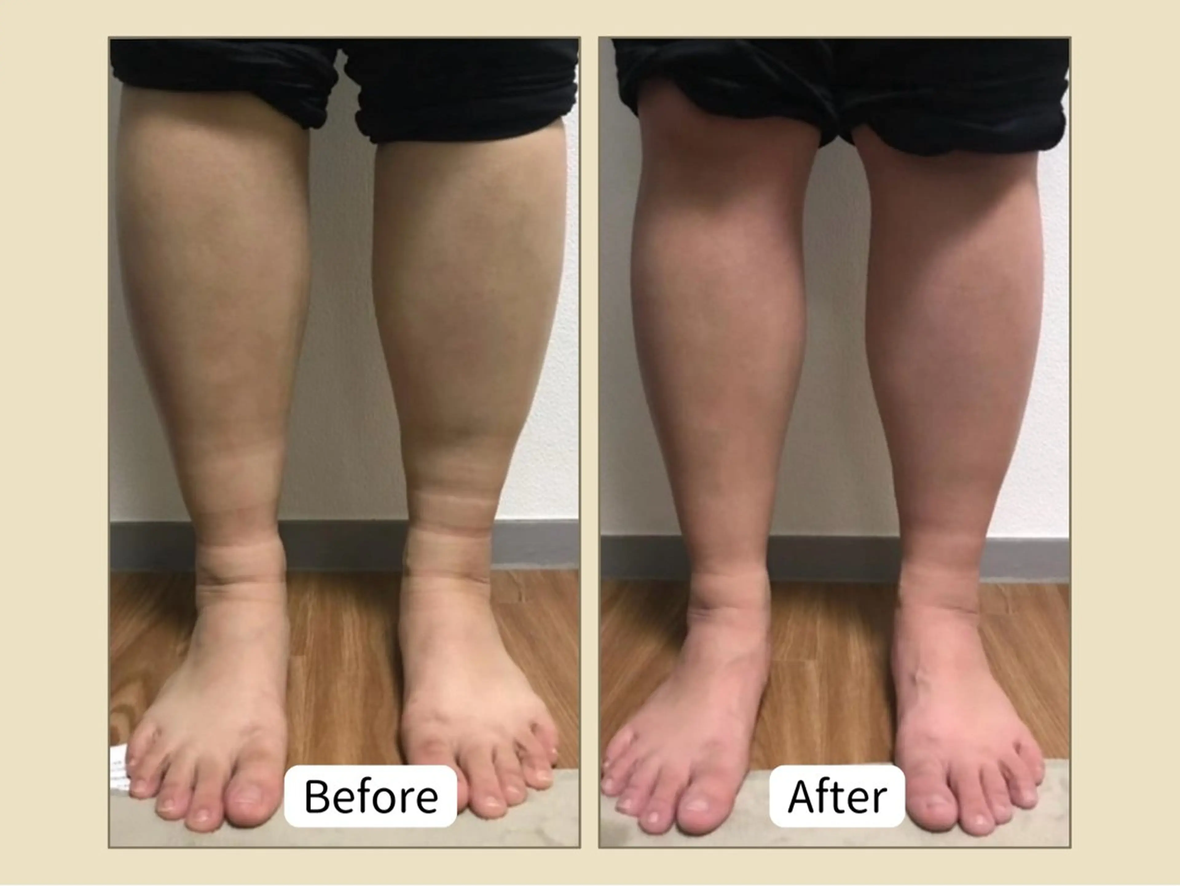 最先端よもぎ蒸し＋美脚ケア80分¥9,800→¥6,800の写真