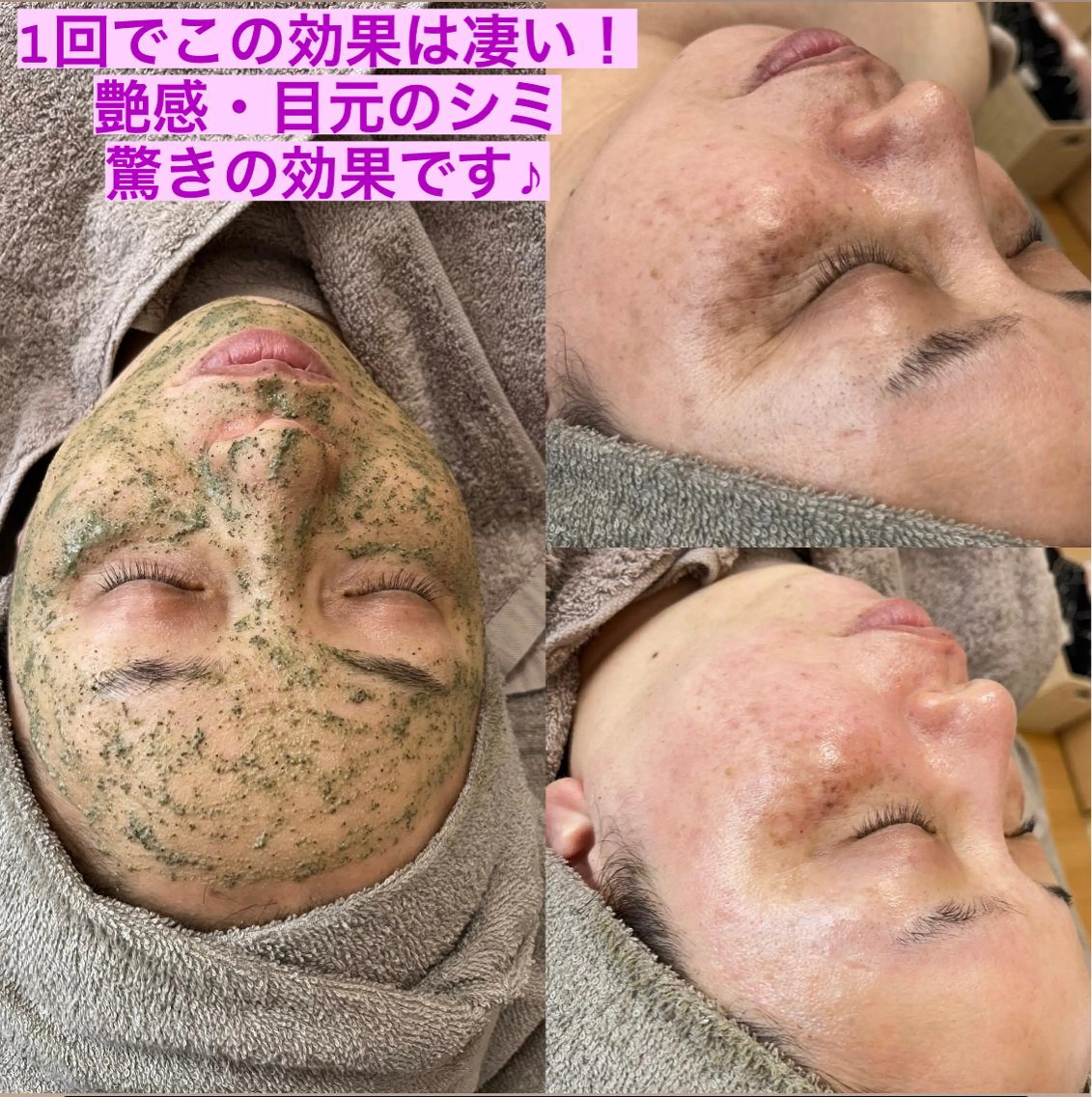 エステ Beauty  Nailのネイルデザイン