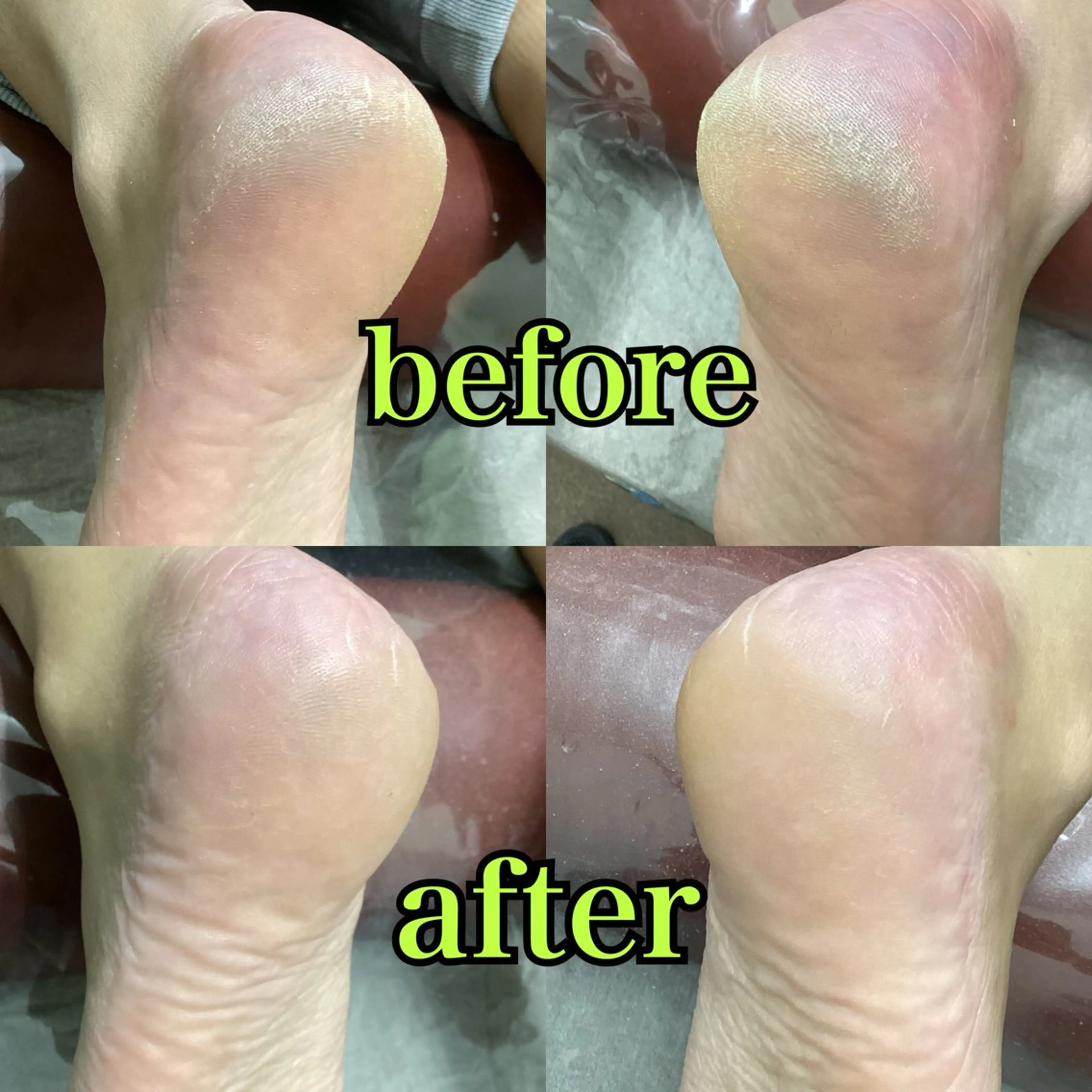 リラク ヒューマン 鍼灸接骨院所属・リラク/ヘッドスパ/ 足裏ケア/蛭川栞のエステ・リラクイメージ