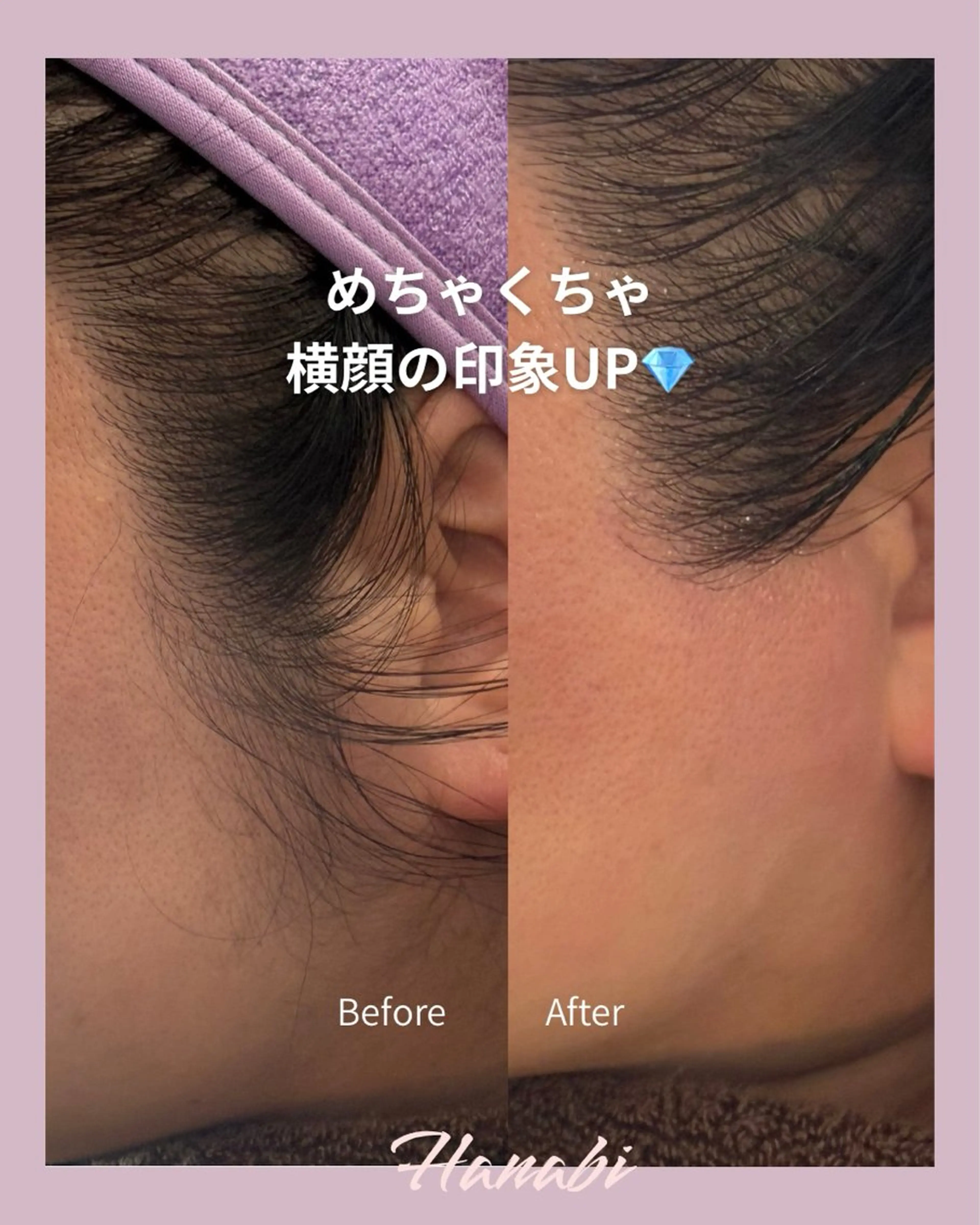 エステ 毛穴専門サロン Hanabiのエステ・リラクイメージ