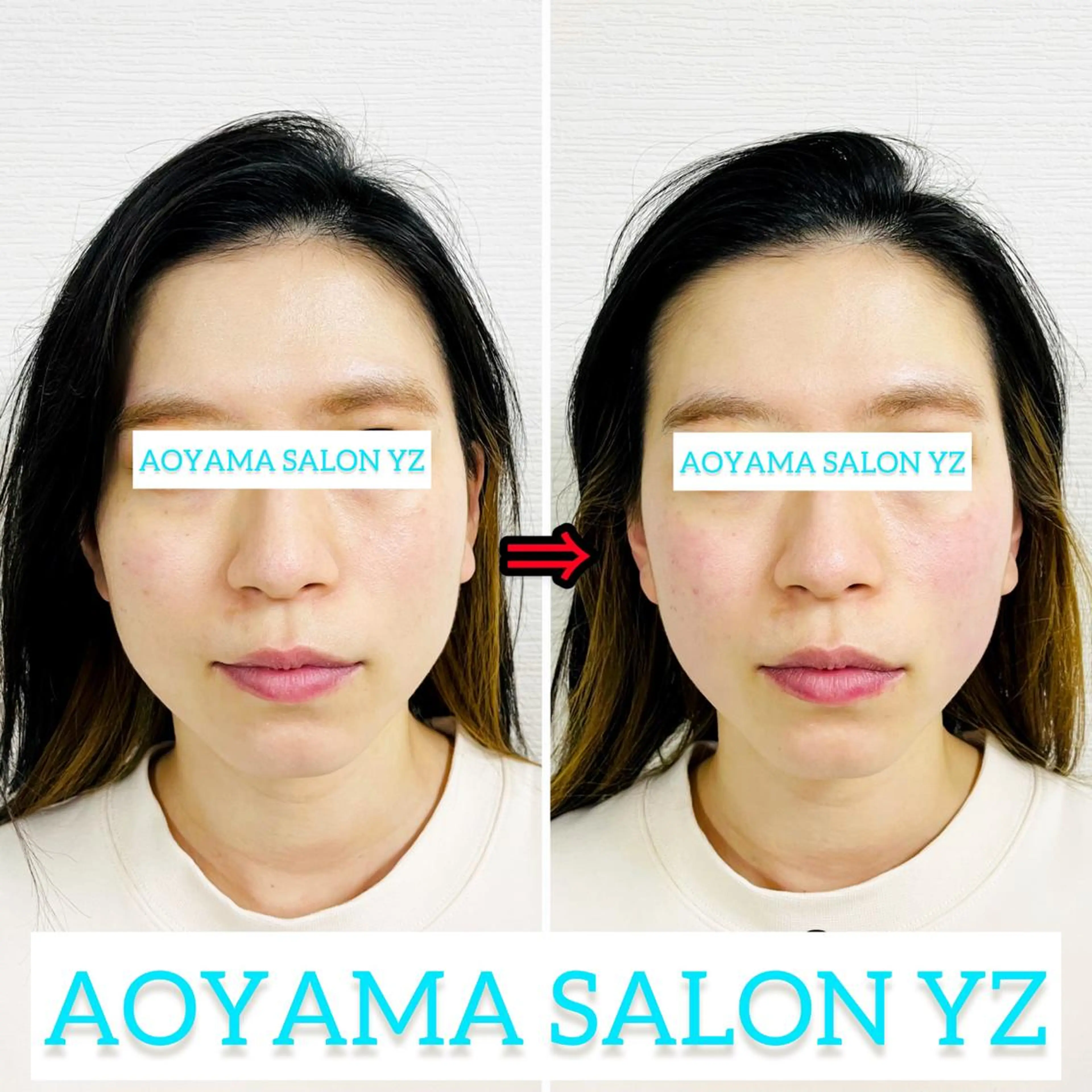 小顔美容鍼専門サロン 渋谷YZのその他イメージ