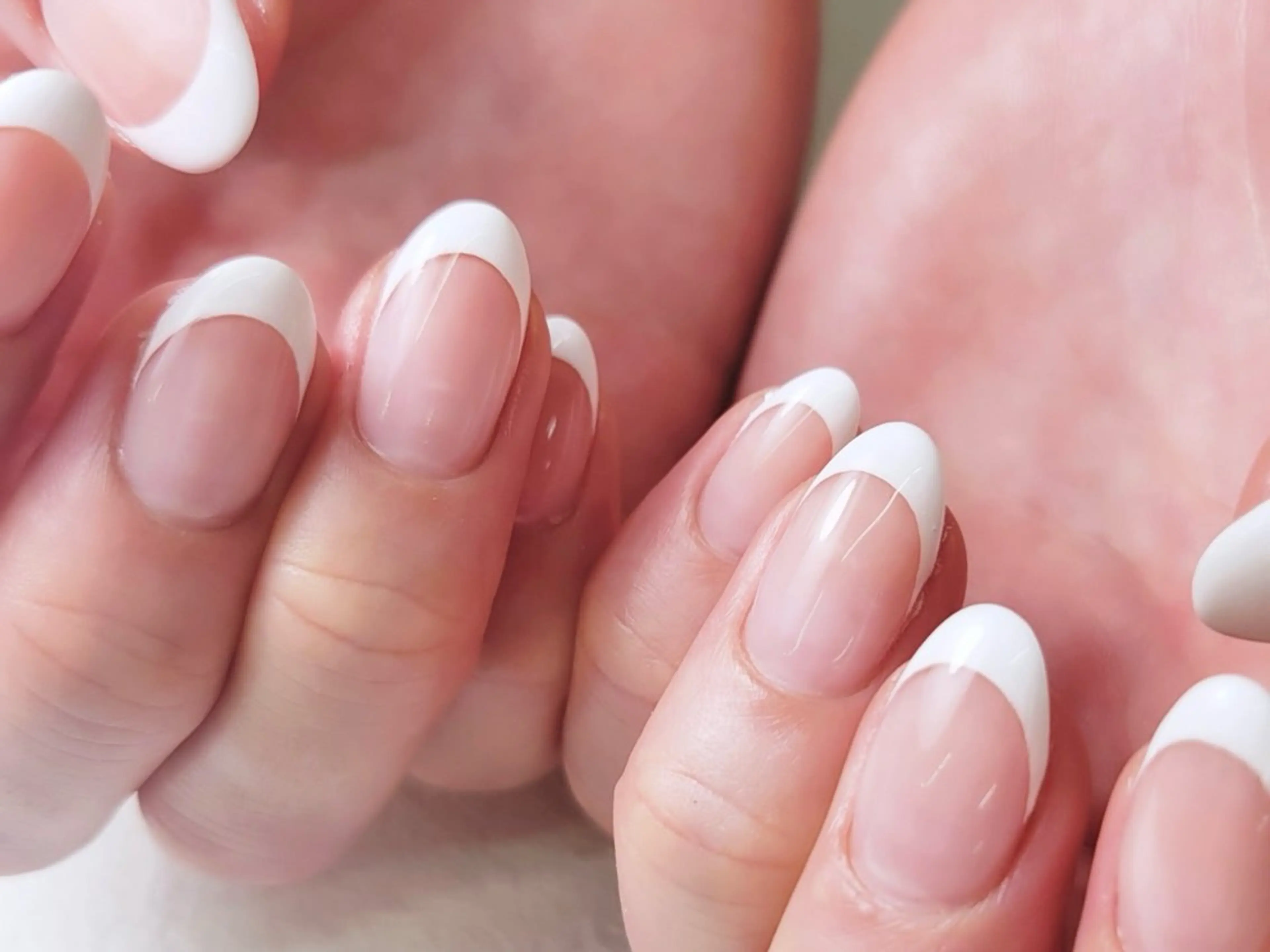 フレンチ【オフケア込み】【フィルイン】の写真