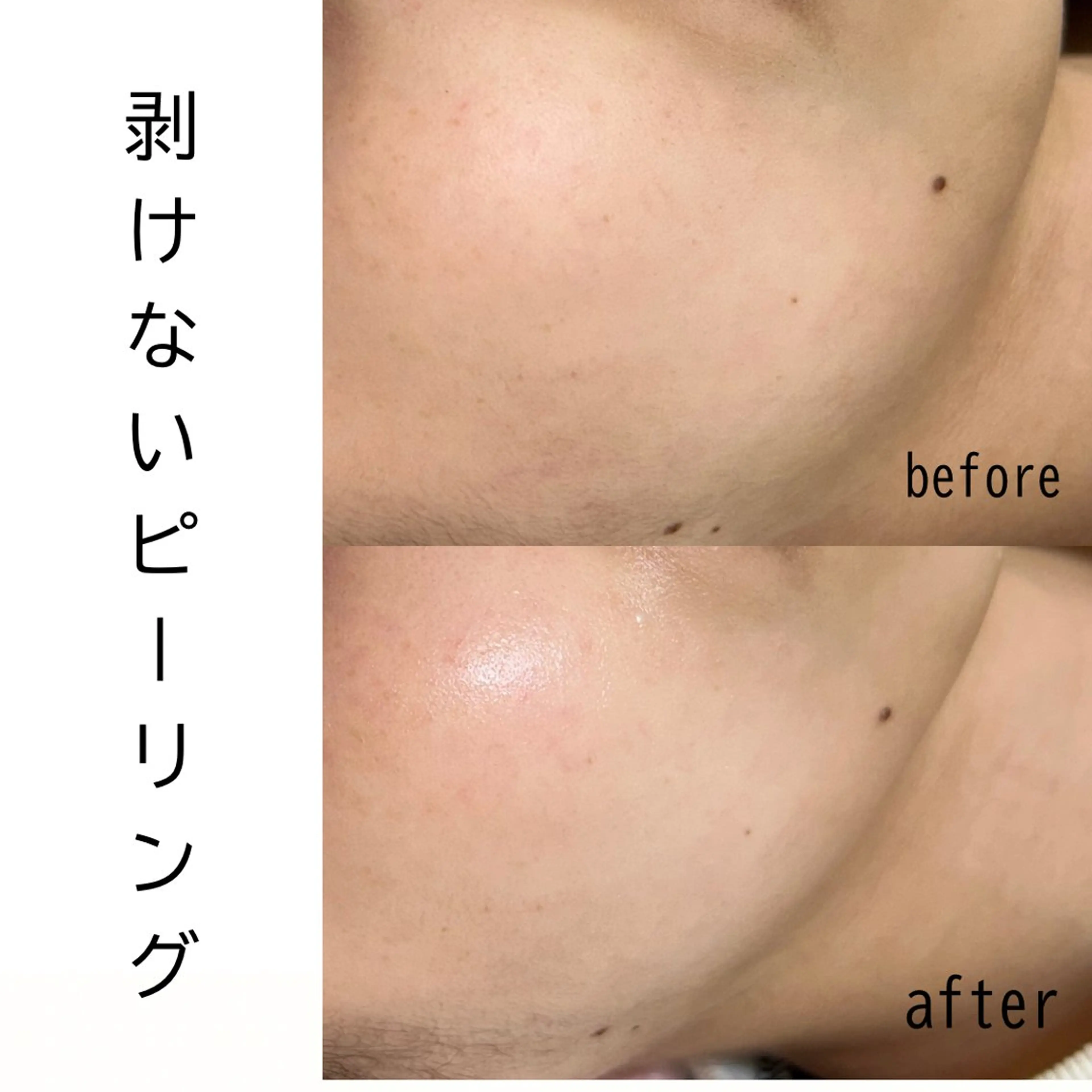 メンズ エステ 歌舞伎町深夜サロン to mëのエステ・リラクイメージ