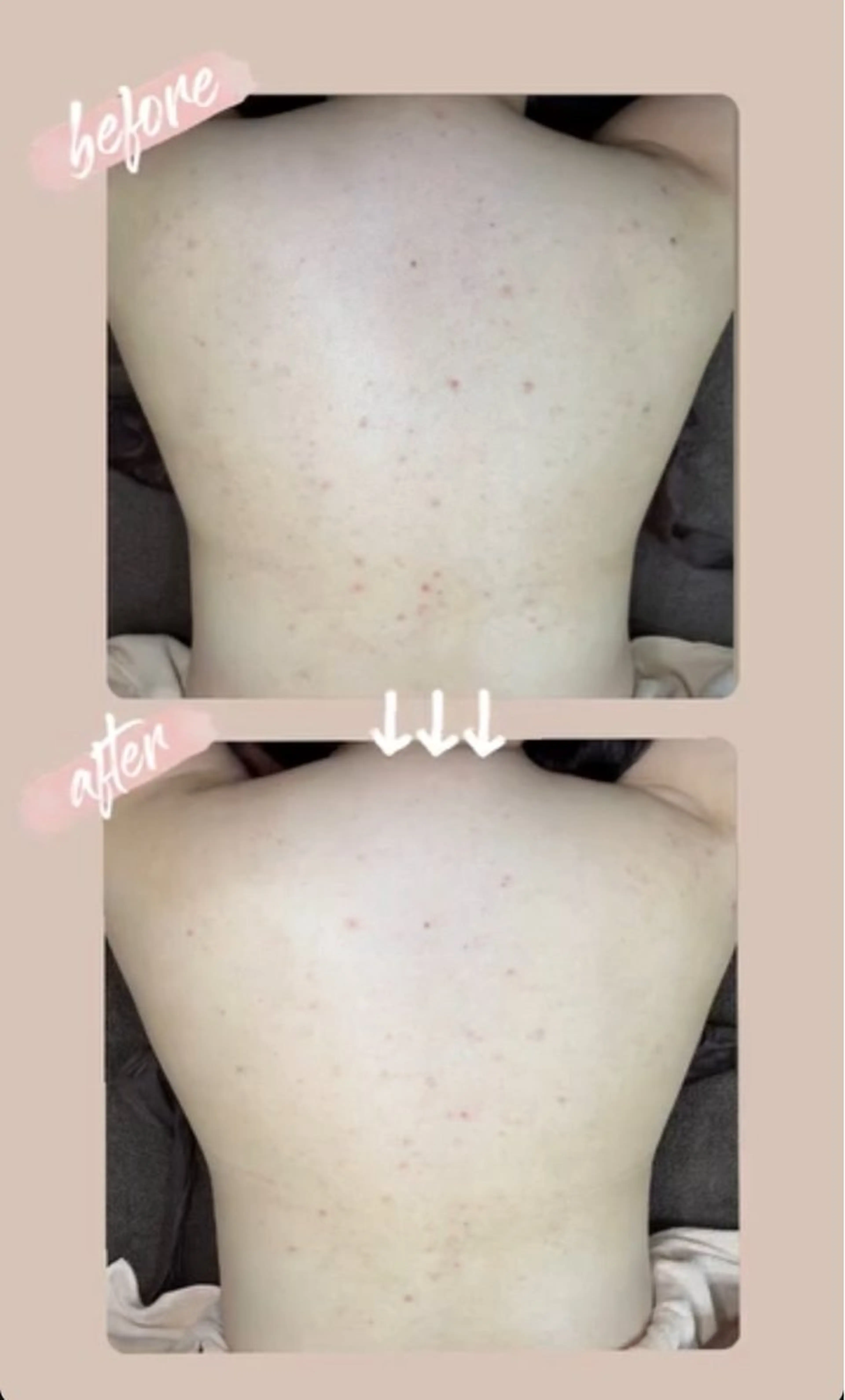 エステ ベラージュ【美背中・ 美尻・フェイシャル】のエステ・リラクイメージ