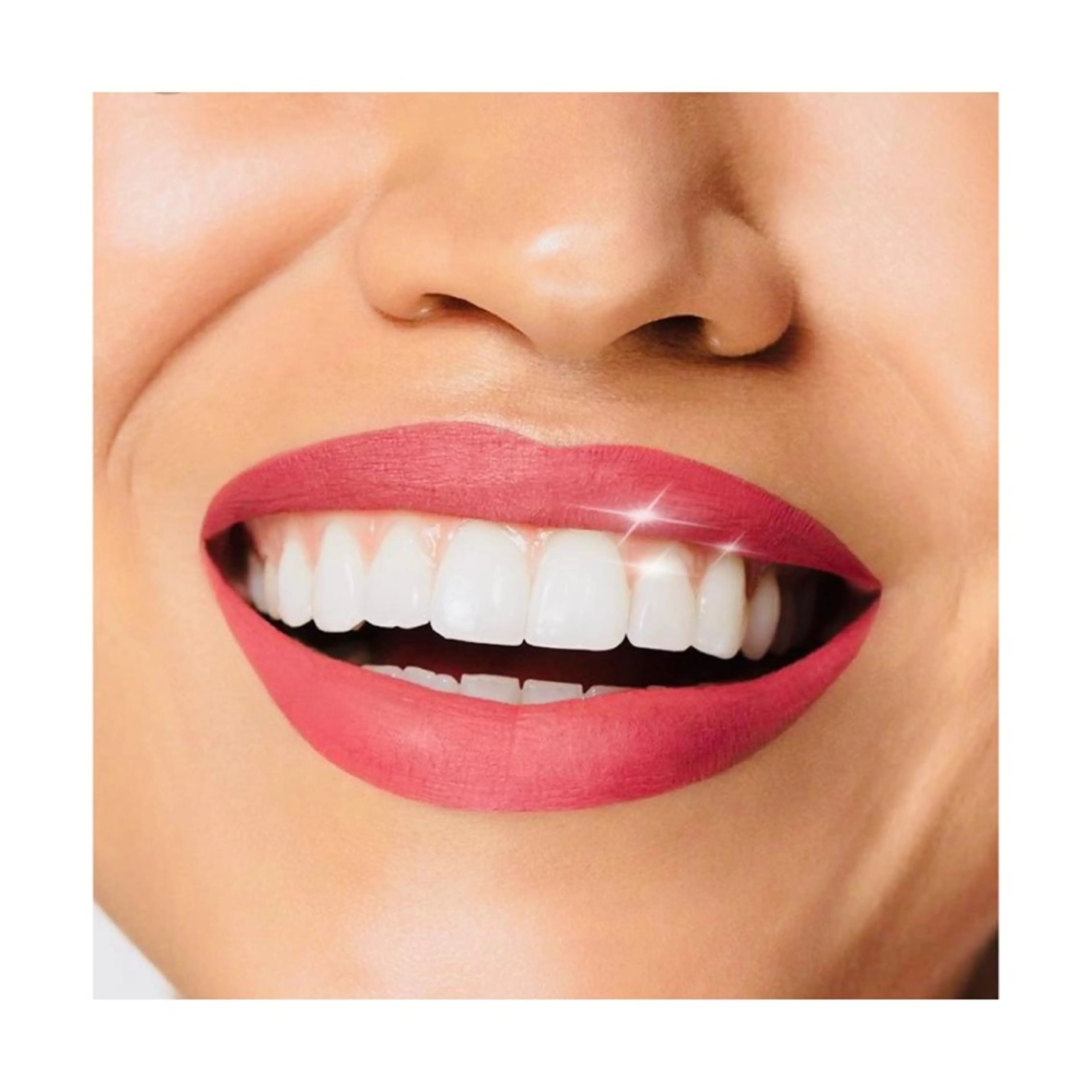 〈新規〉歯のホワイトニング🦷の写真