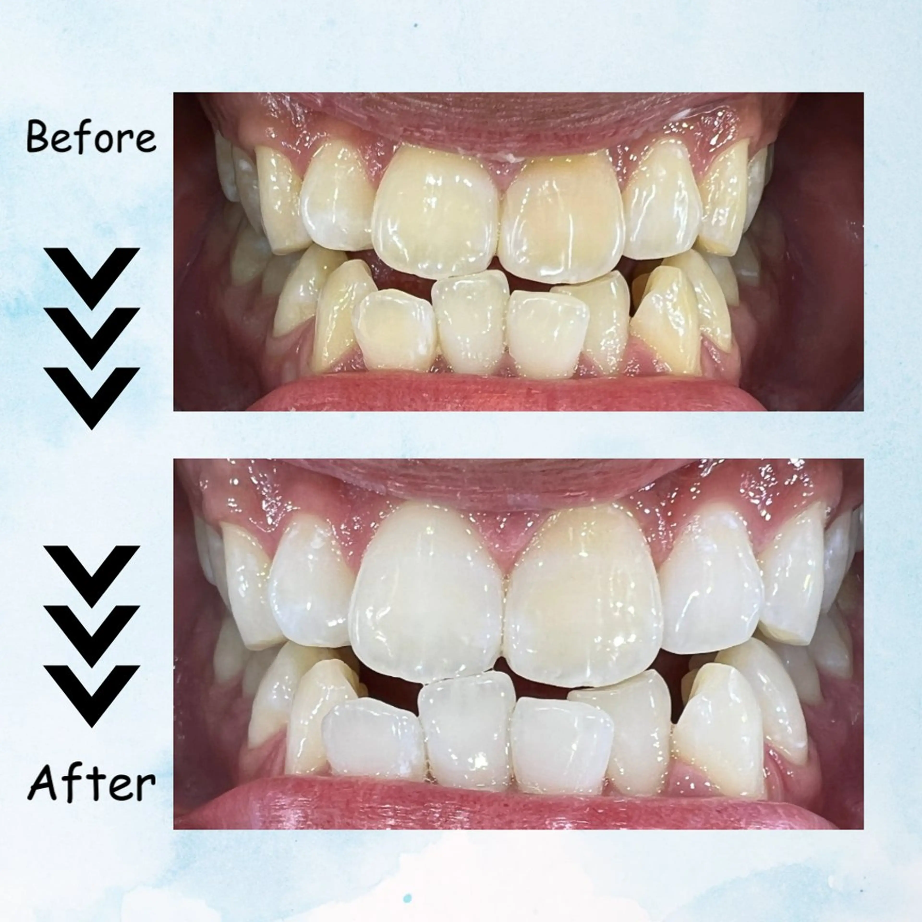 メンズ その他 セルフホワイトニング エクシア塩釜口駅前店所属・セルフホワイトニング エクシア塩釜口駅前店のその他イメージ