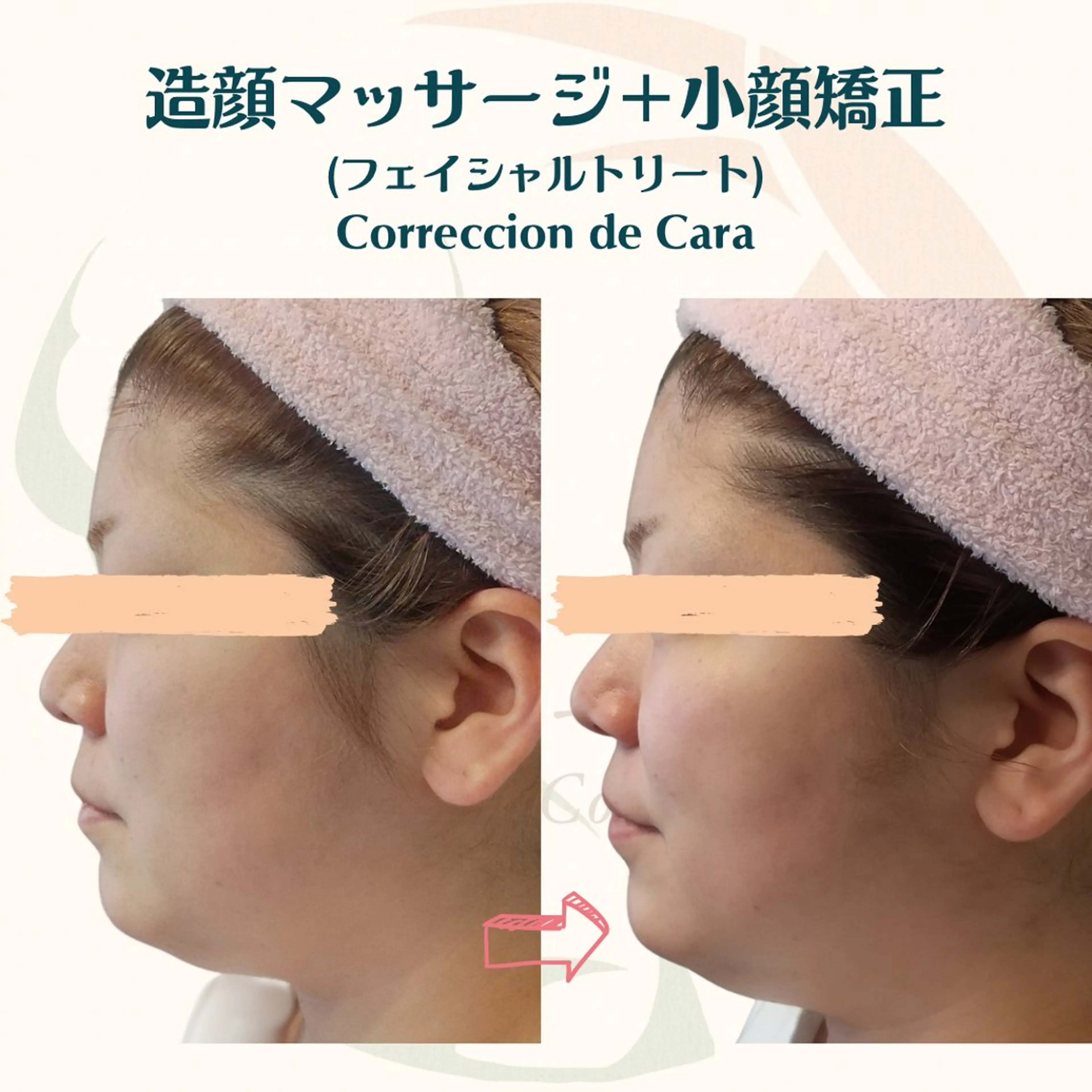 小顔矯正☀︎バスト ☀︎ハルのエステ・リラクイメージ