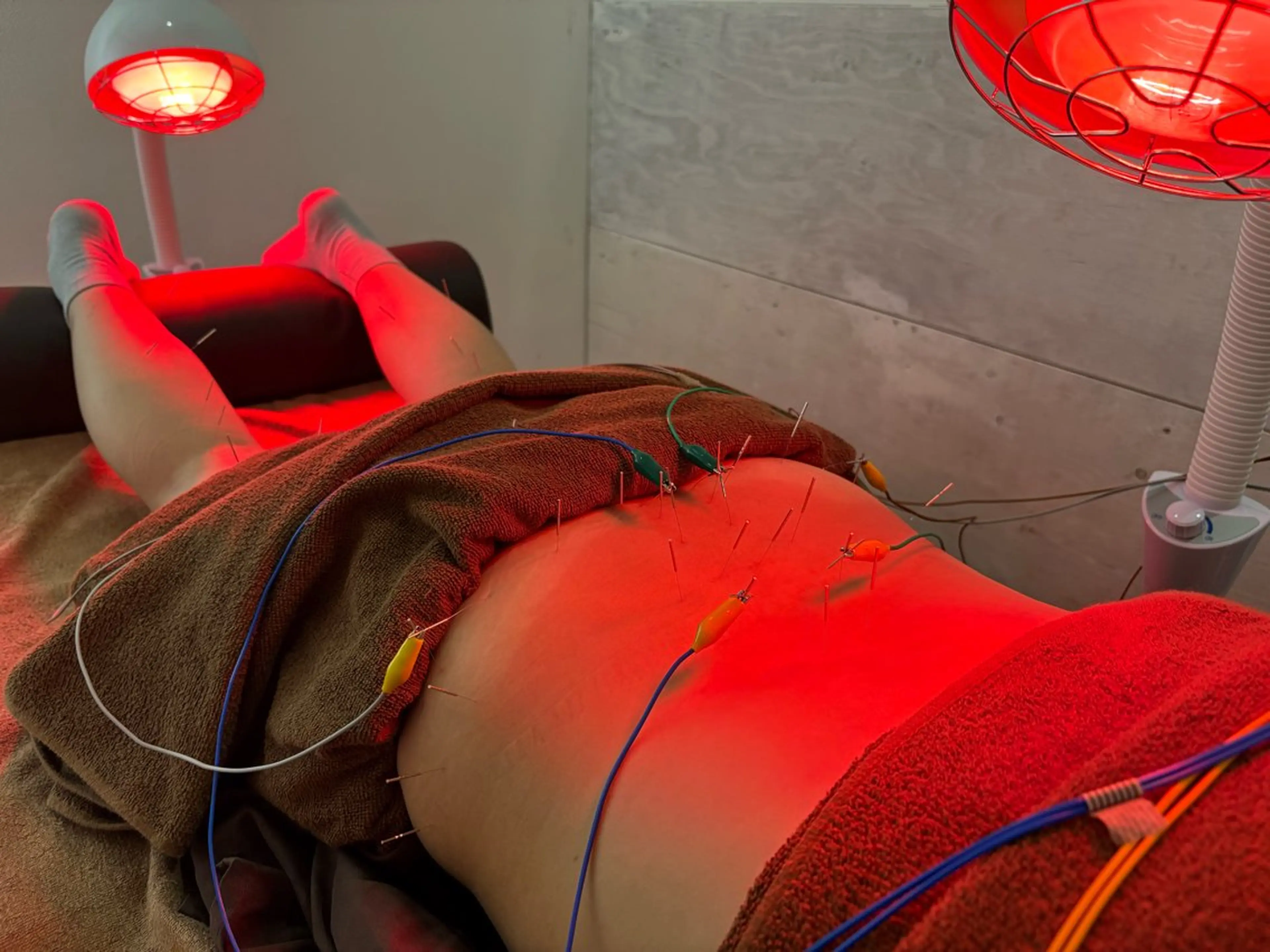 Spring鍼灸院所属・Spring鍼灸院 ✨首肩こり、腰痛に！のエステ・リラクイメージ