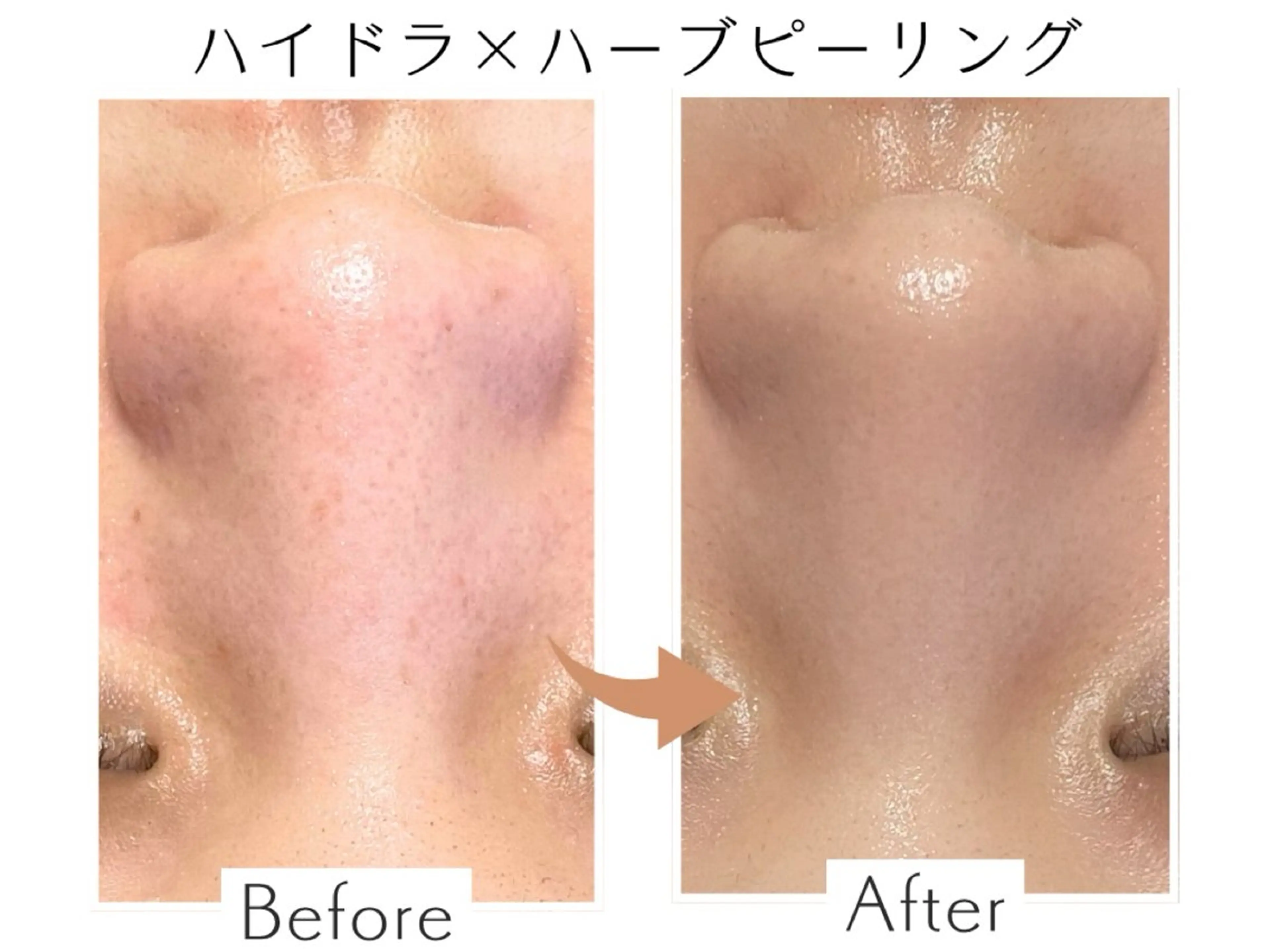 エステ プライベートサロン Belle（ベル）のエステ・リラクイメージ