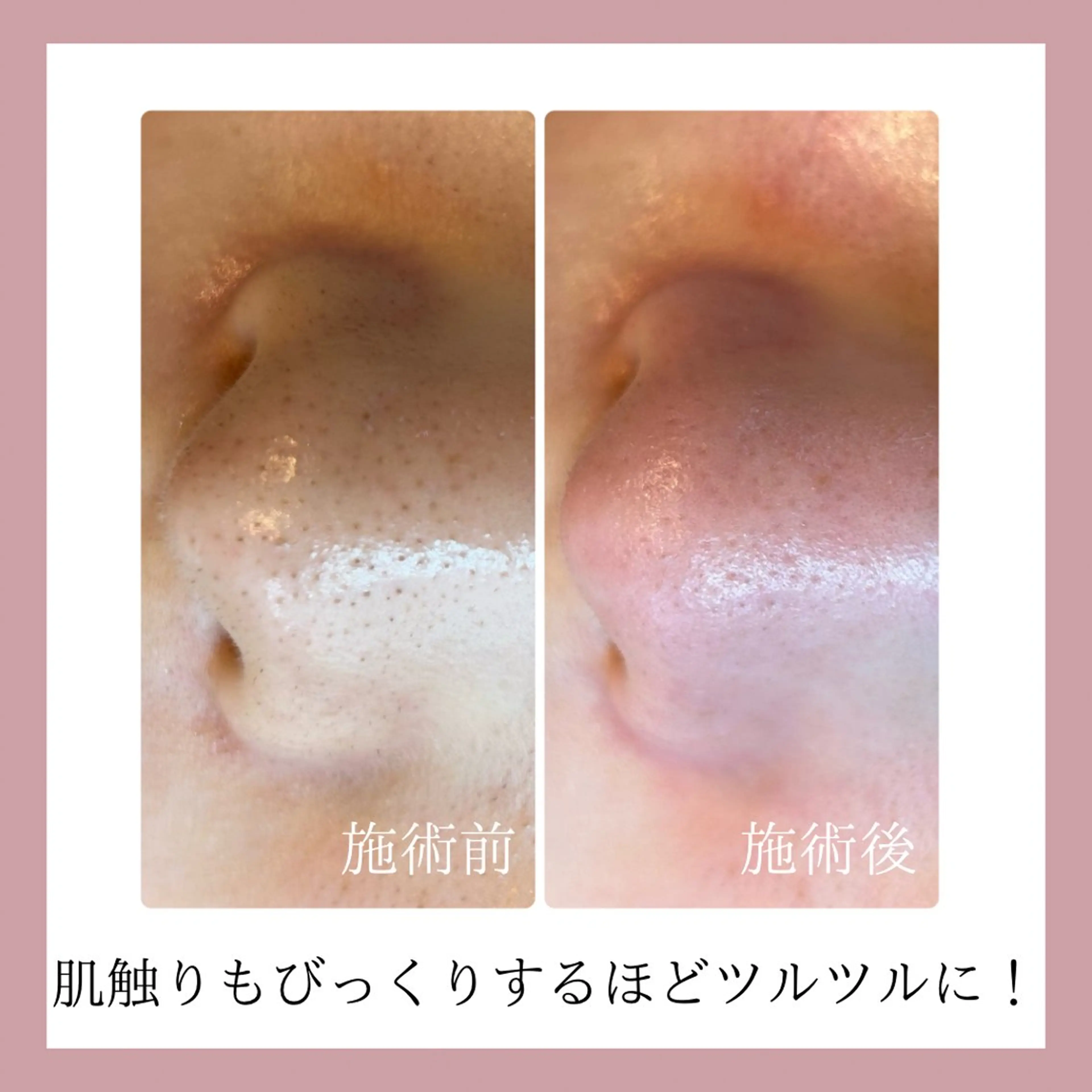 美肌脱毛&毛穴専門 Nico🐰ྀི♡のエステ・リラクイメージ