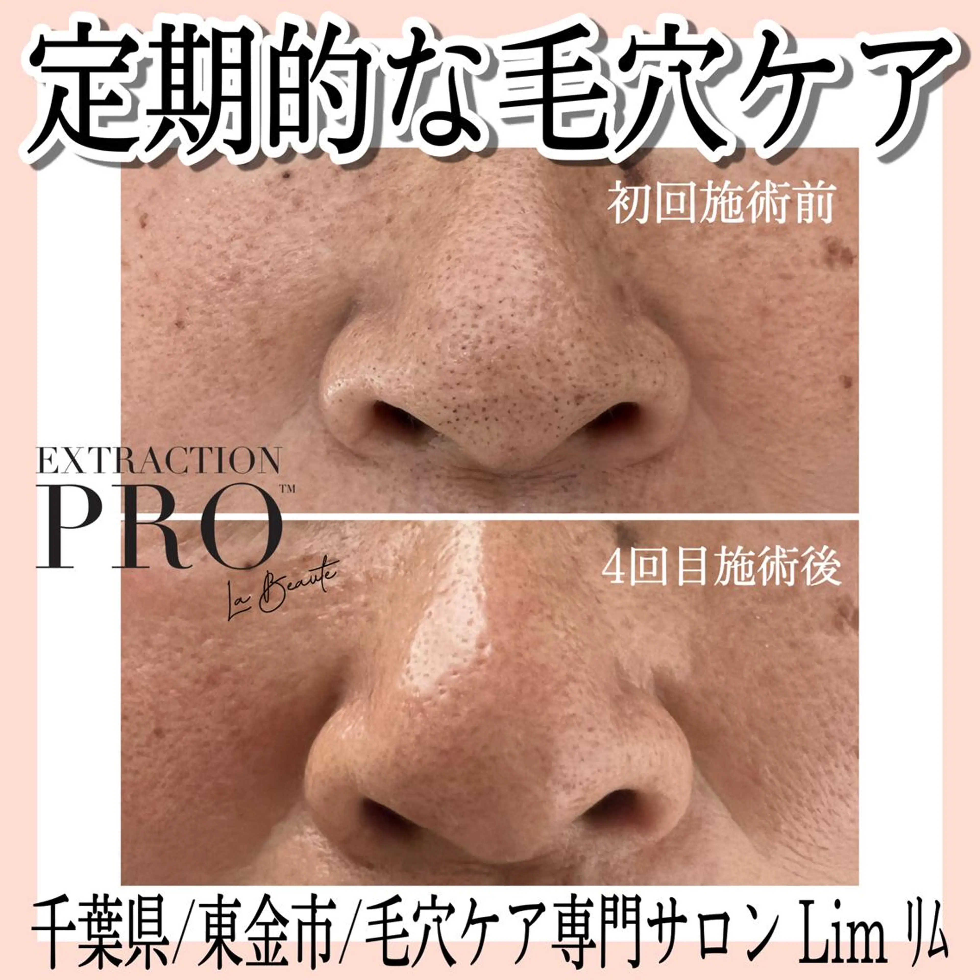 Lim Naomiのマツエク・マツパデザイン