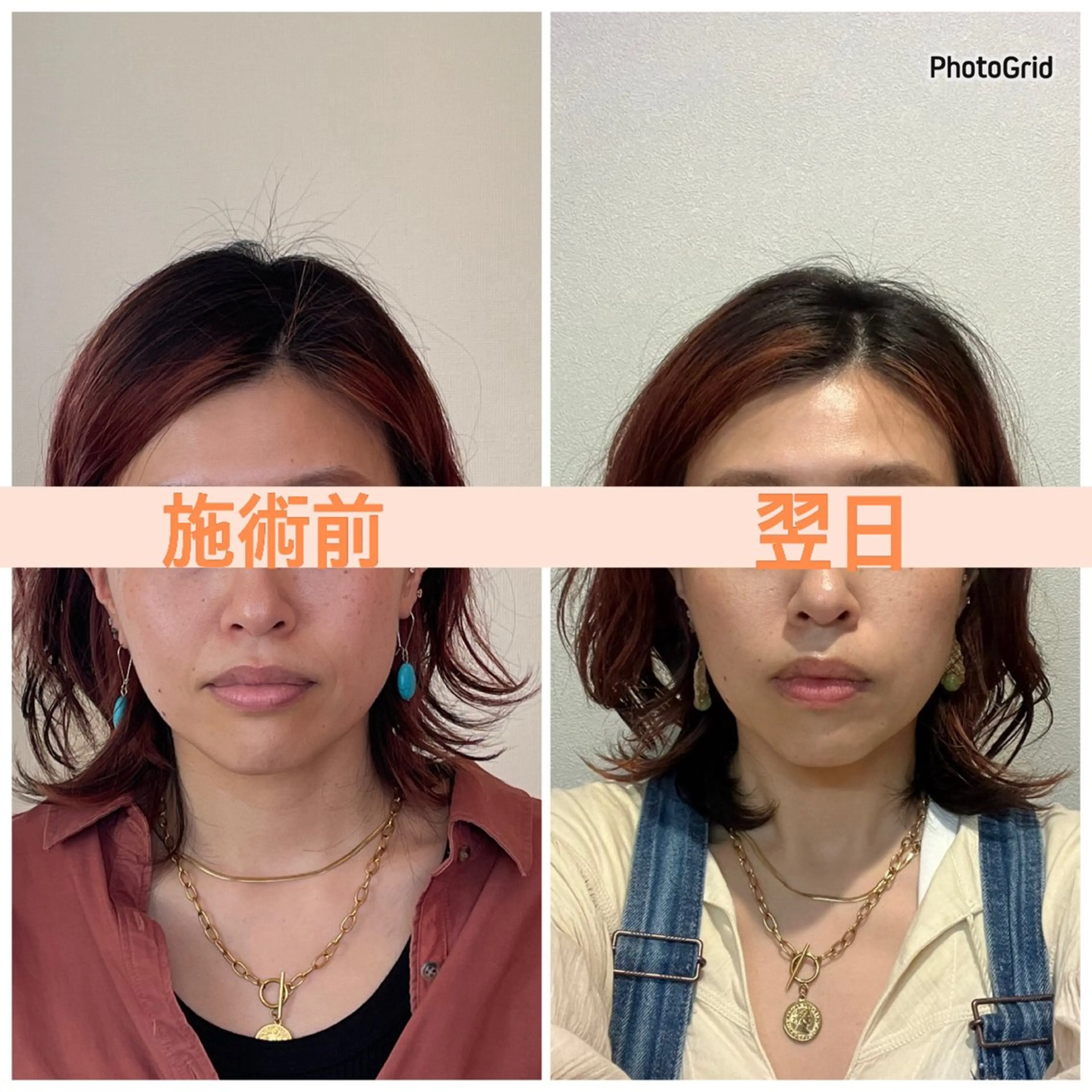 小顔矯正サロン　ReFace Fusae（リフェイスフサエ）所属・小顔矯正サロン リフェイスフサエのエステ・リラクイメージ