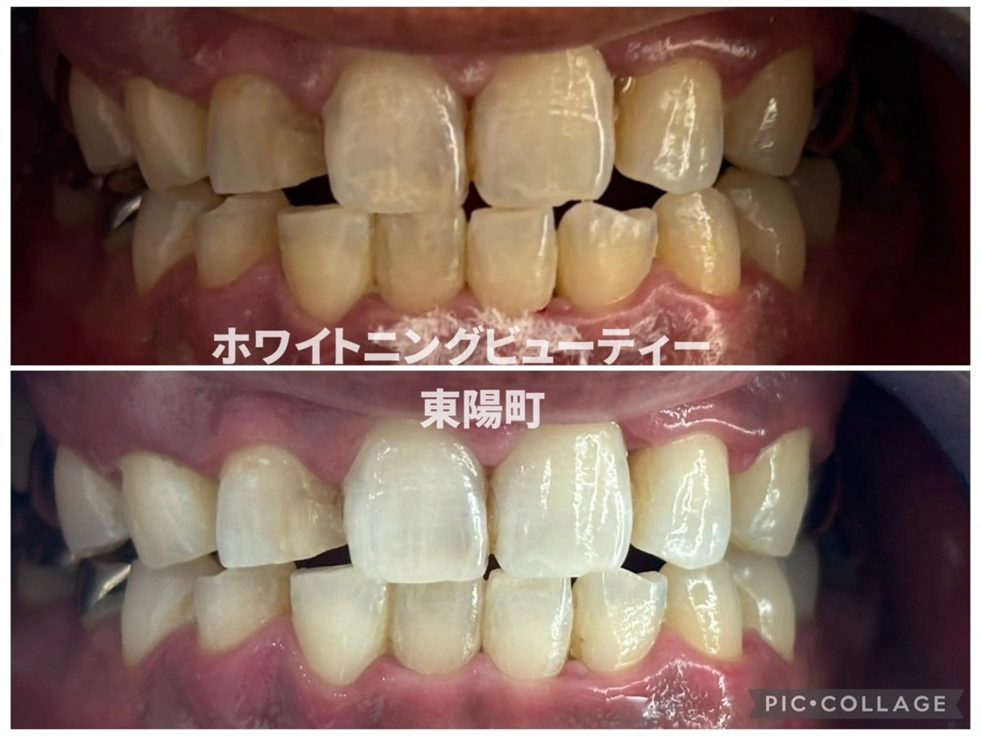 その他 ホワイトニングビューティー東陽町店所属・ホワイトニング ビューティー東陽町店のその他イメージ