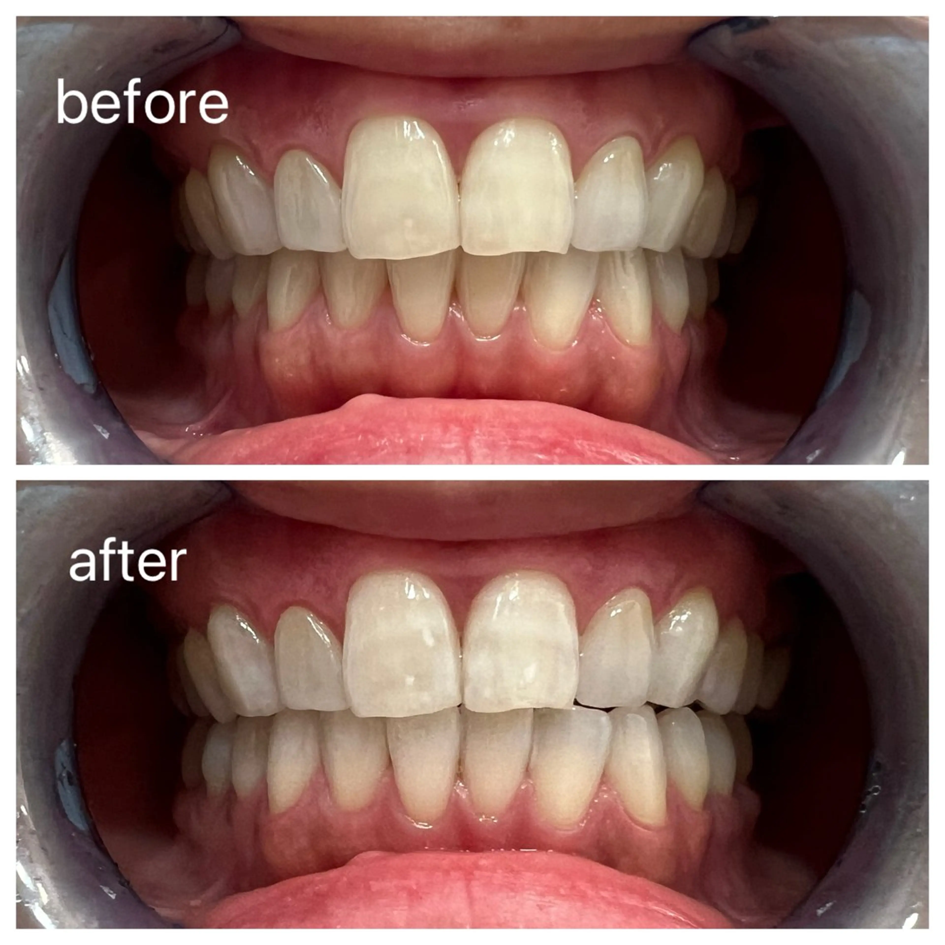 セルフホワイトニング Shineeのエステ・リラクイメージ