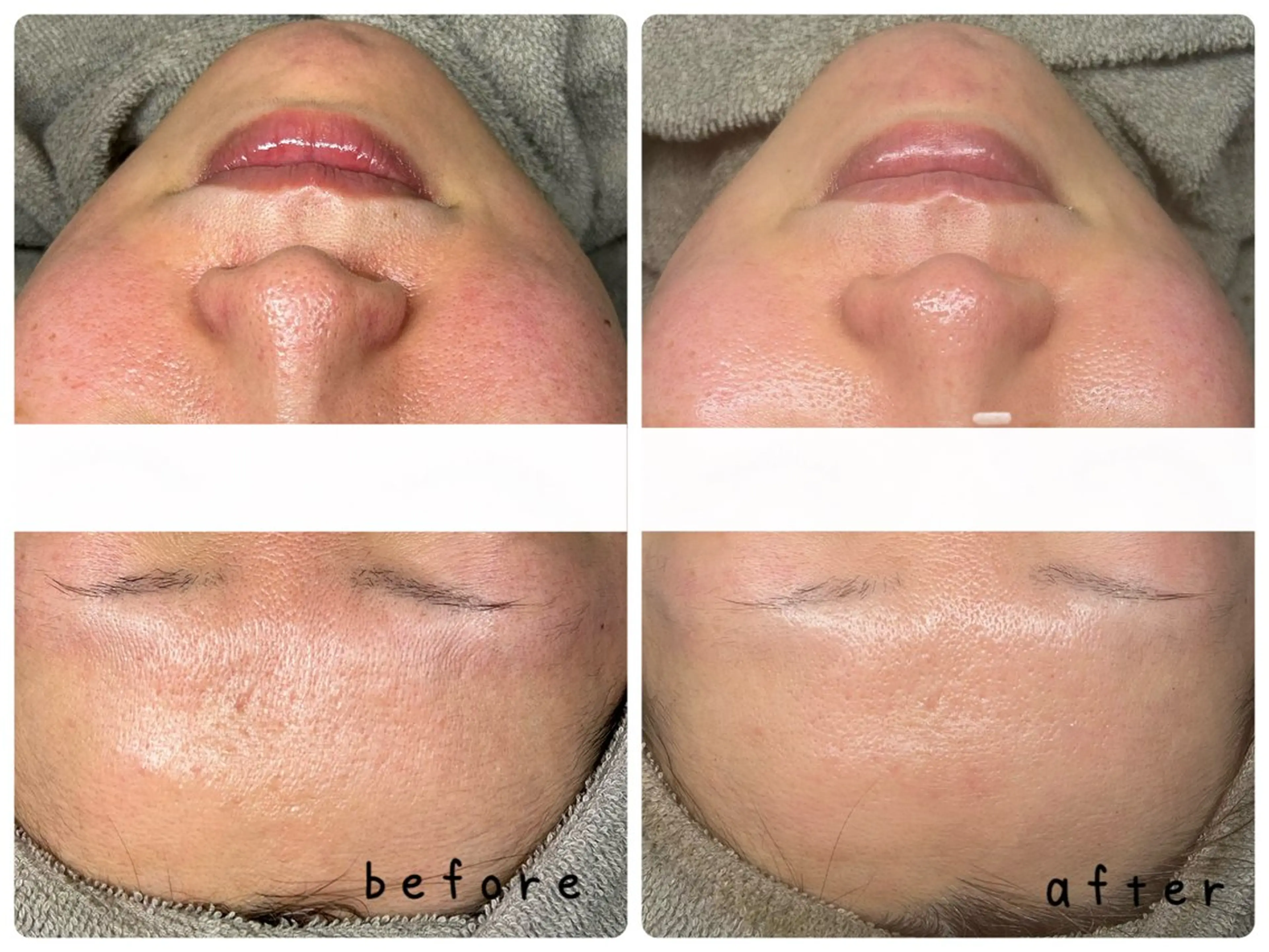 【医療提携サロン】Mbelle所属・🌿越谷レイクタウン Mbelle🌿のエステ・リラクイメージ