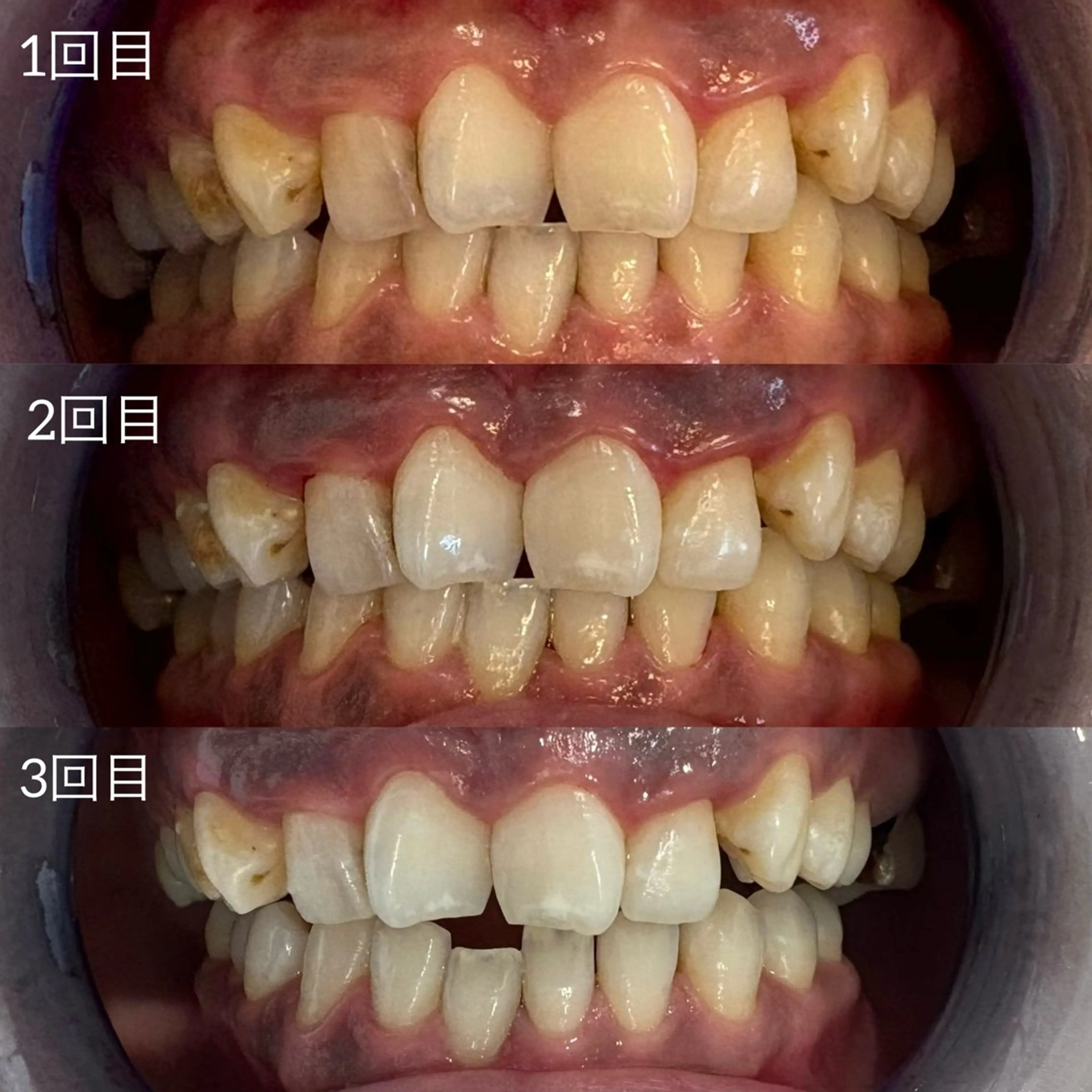 メンズ キッズ エステ ホワイトニングサロン Ecru所属・ホワイトニングサロン Ecru エクリュのその他イメージ
