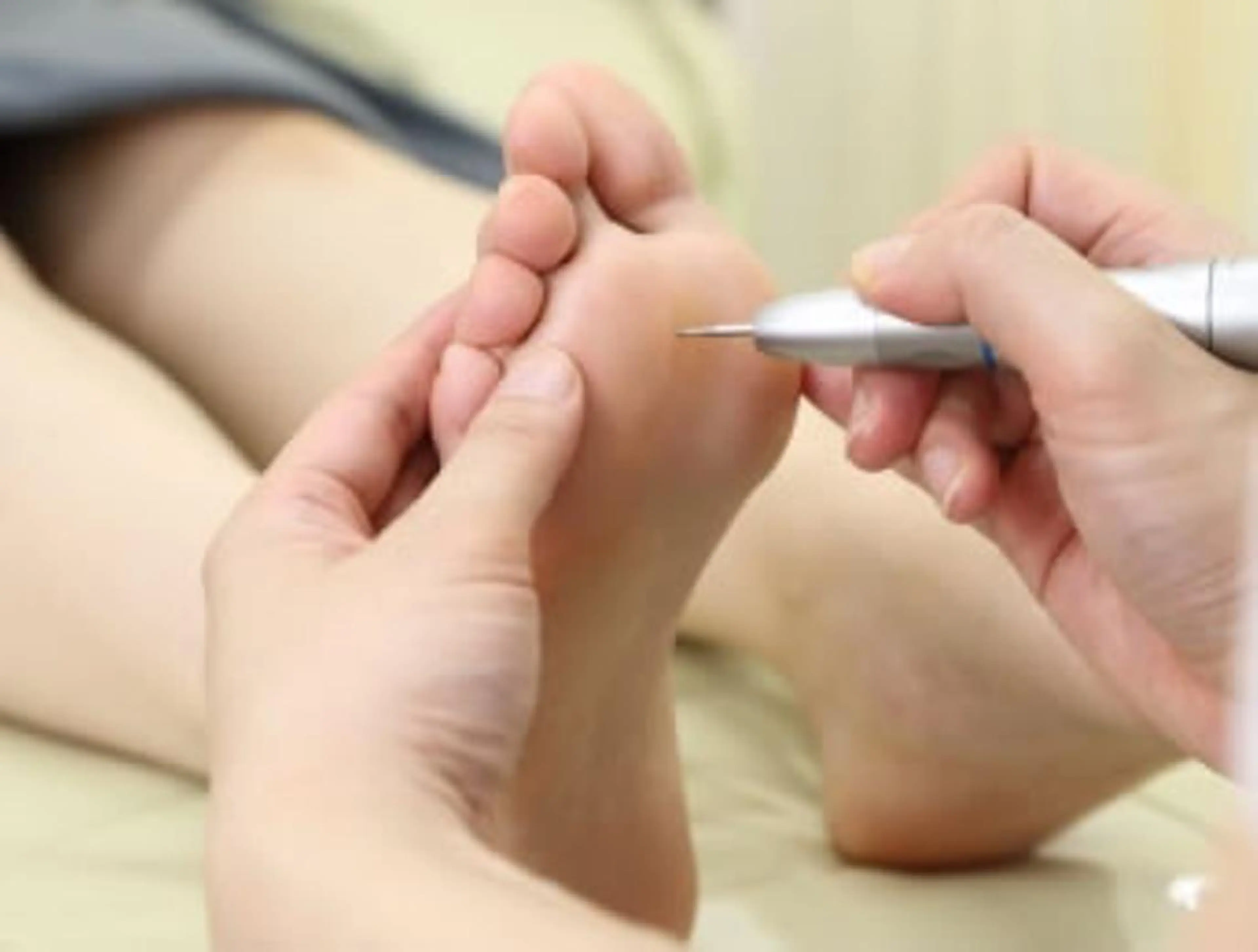 【足の専門家】タコ・うおのめケア　60分​〜​　6600円​〜​【初診料別途550円】の写真