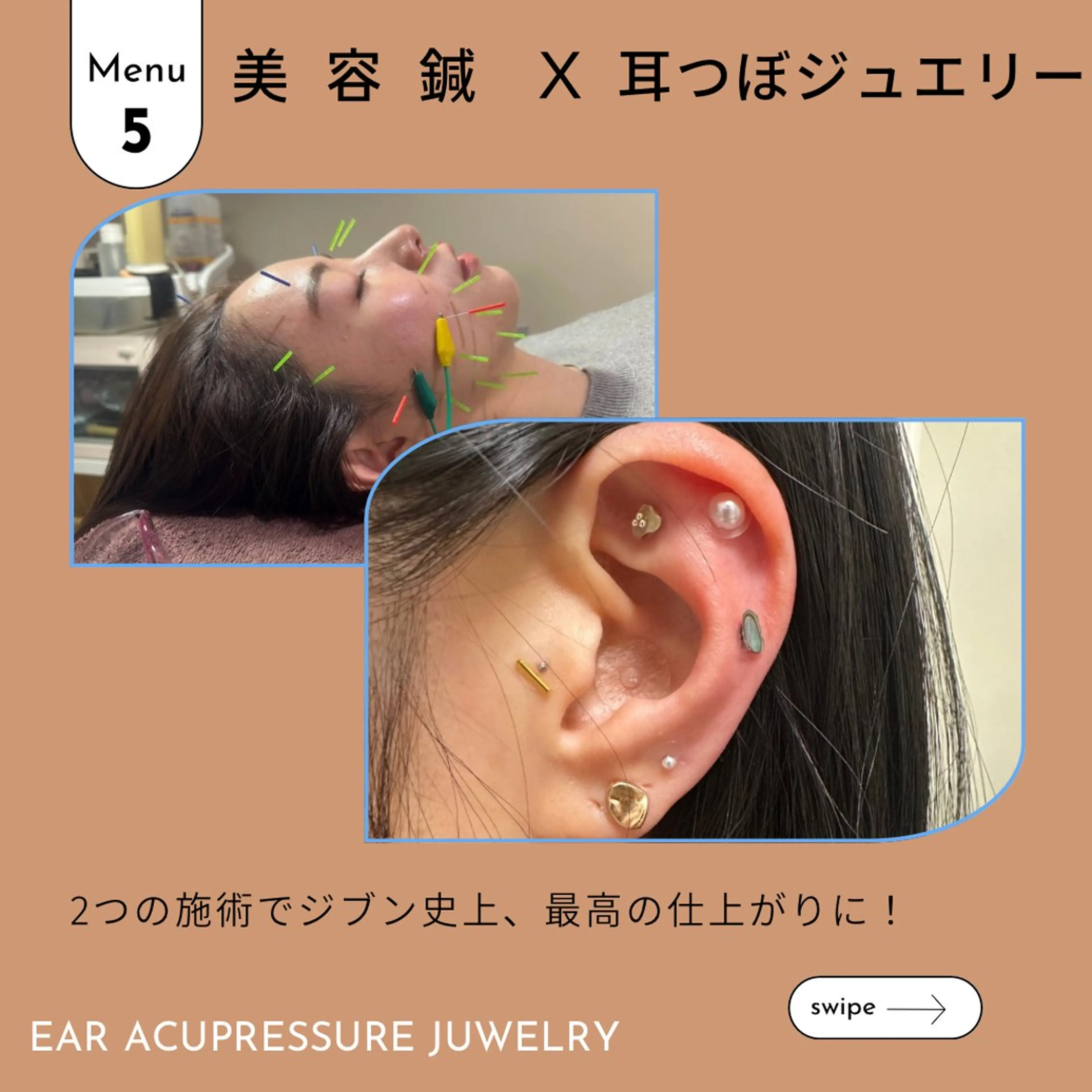 🤍ヘッドスパ付き！美容鍼＋耳ツボジュエリー💎の写真