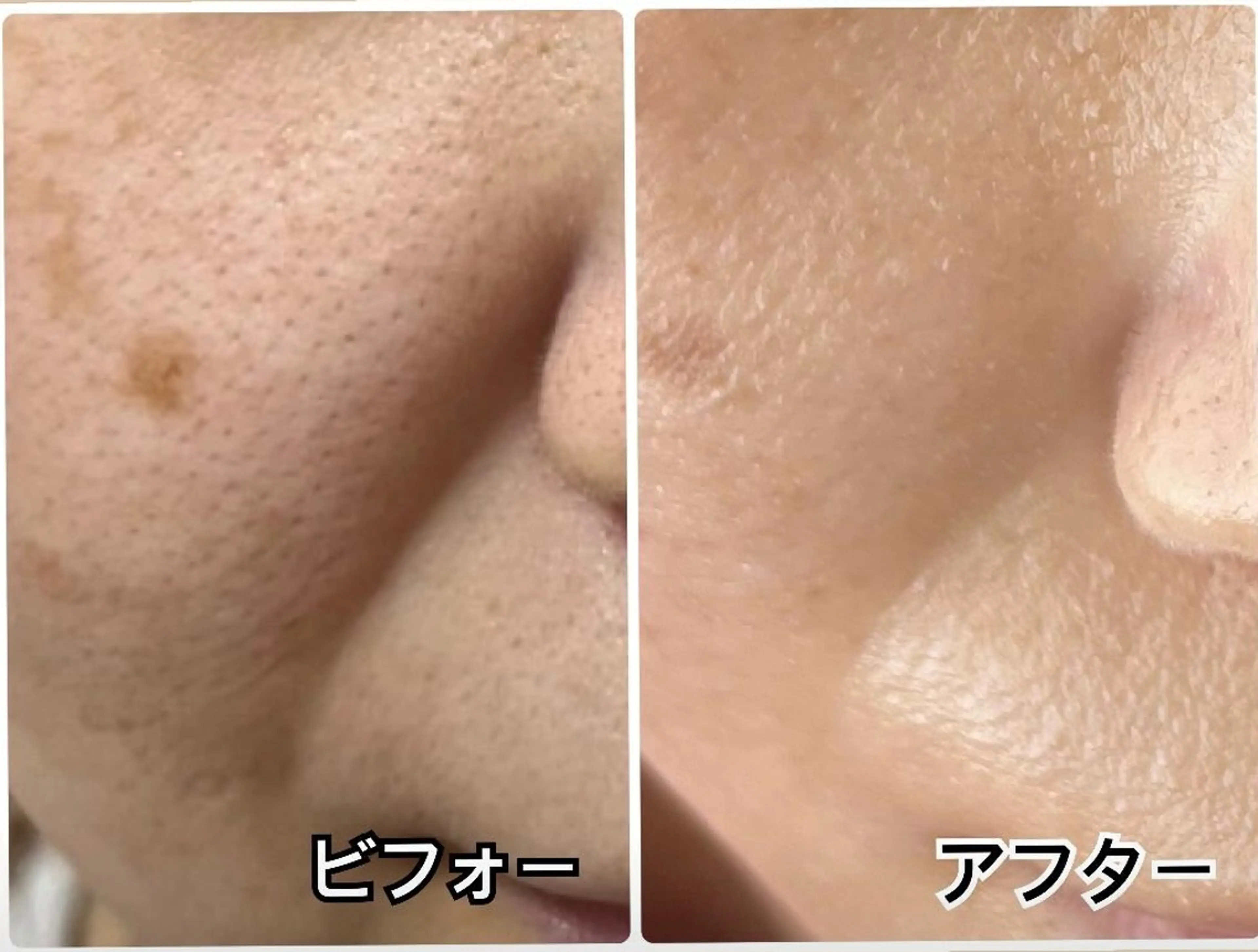 エステ リラク YURUMARU所属・YURUMARU 河ノ瀬店のエステ・リラクイメージ