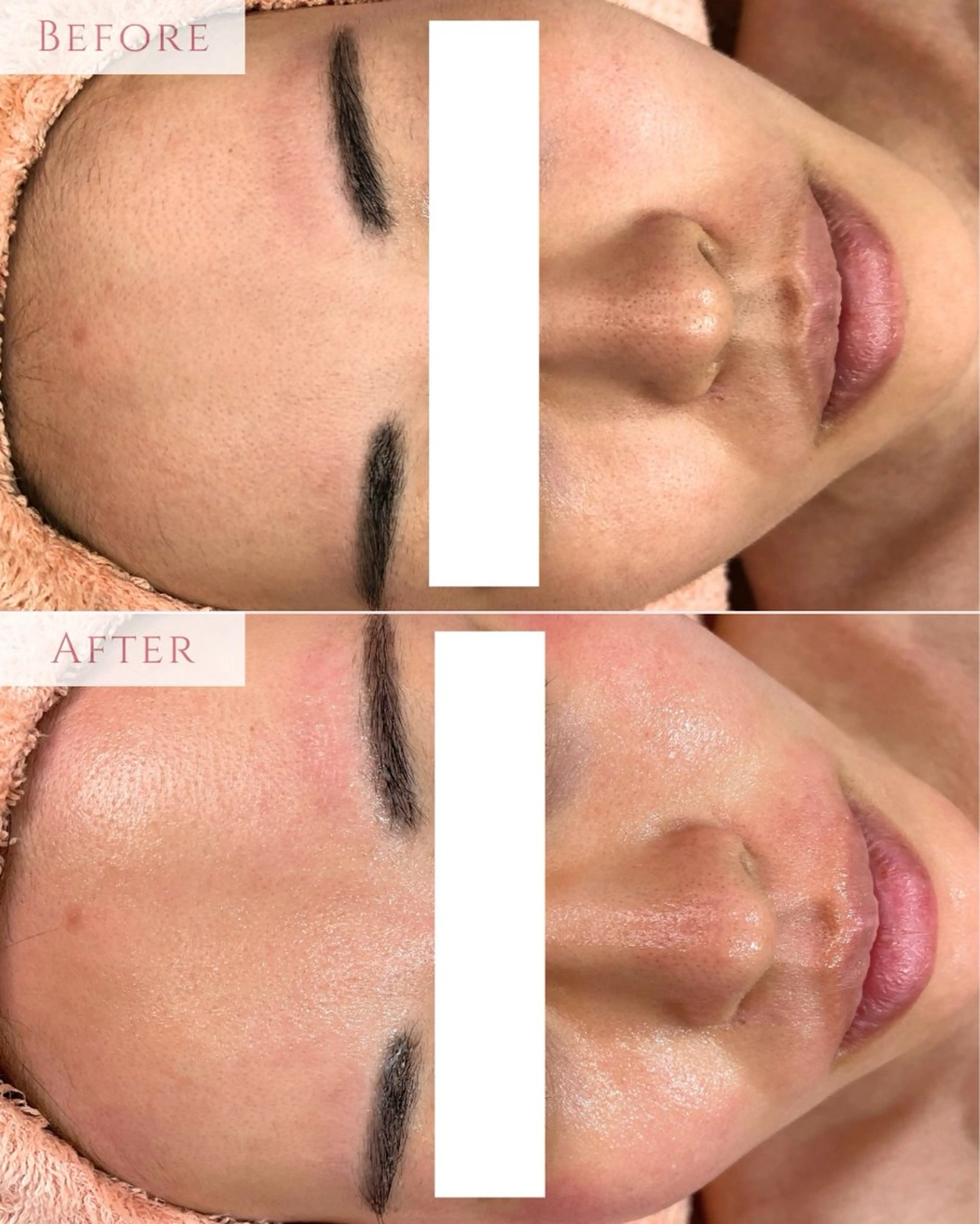 脱毛 肌質改善専門サロン Bellmi/心斎橋のエステ・リラクイメージ