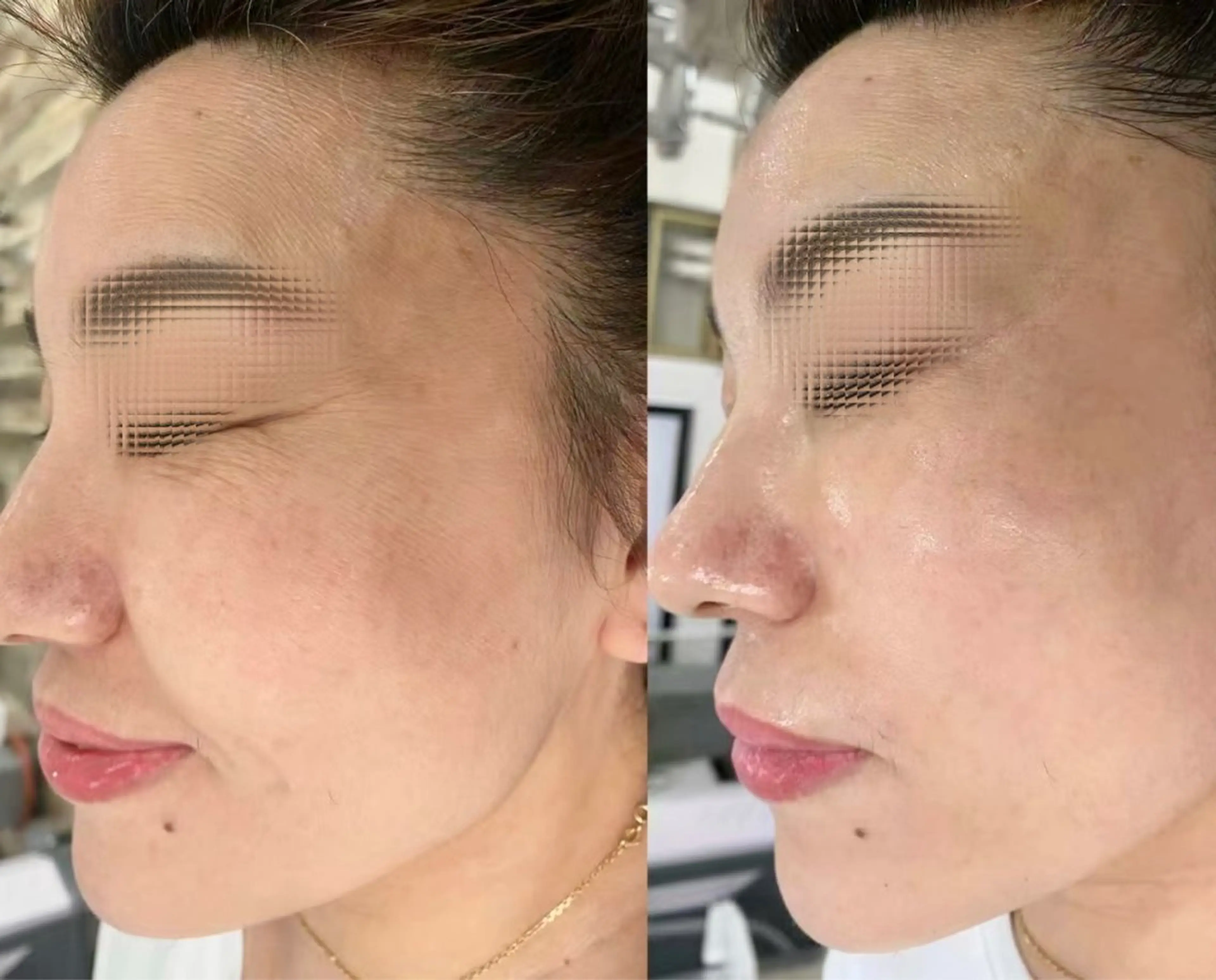 MONICAビューティサロン所属・MONICAサロン ⭐︎フェイシャル痩身のエステ・リラクイメージ