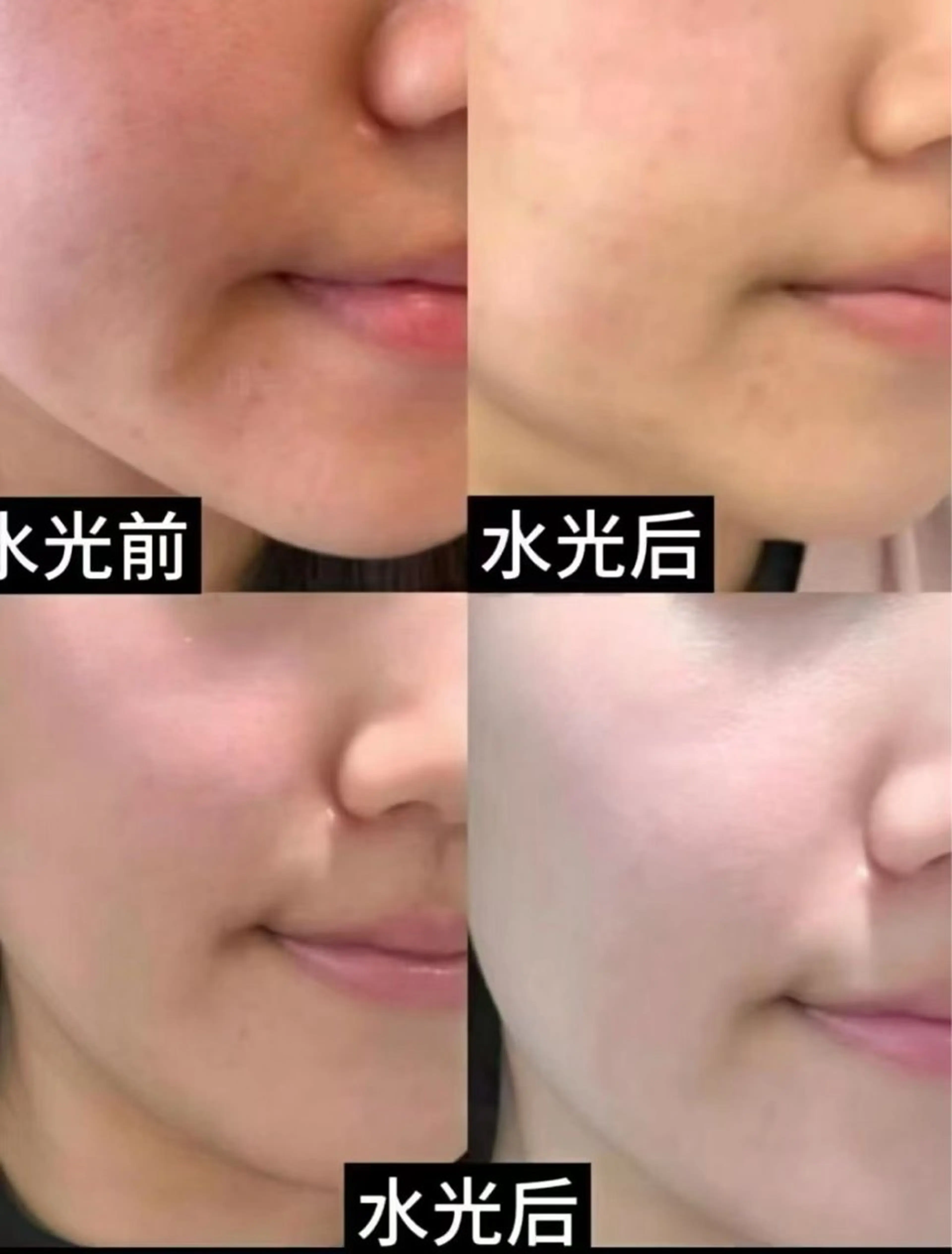 マツエク・マツパ エステ aliaハイフ&水光ジェットサロン所属・aliaハーブ水光店 エステティシャン募集のエステ・リラクイメージ