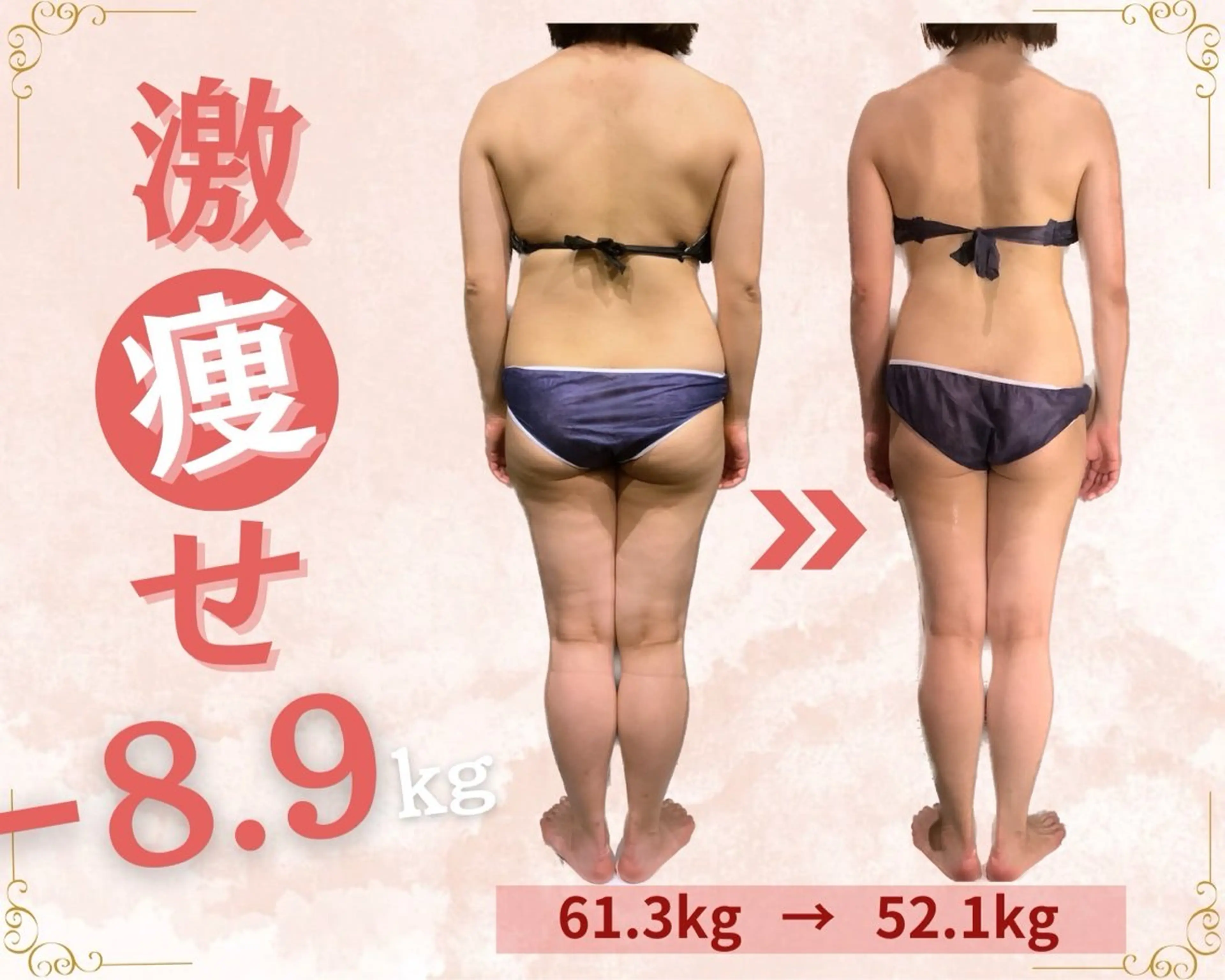 ハイパーナイフ/痩身 🌸CHARME原井のエステ・リラクイメージ