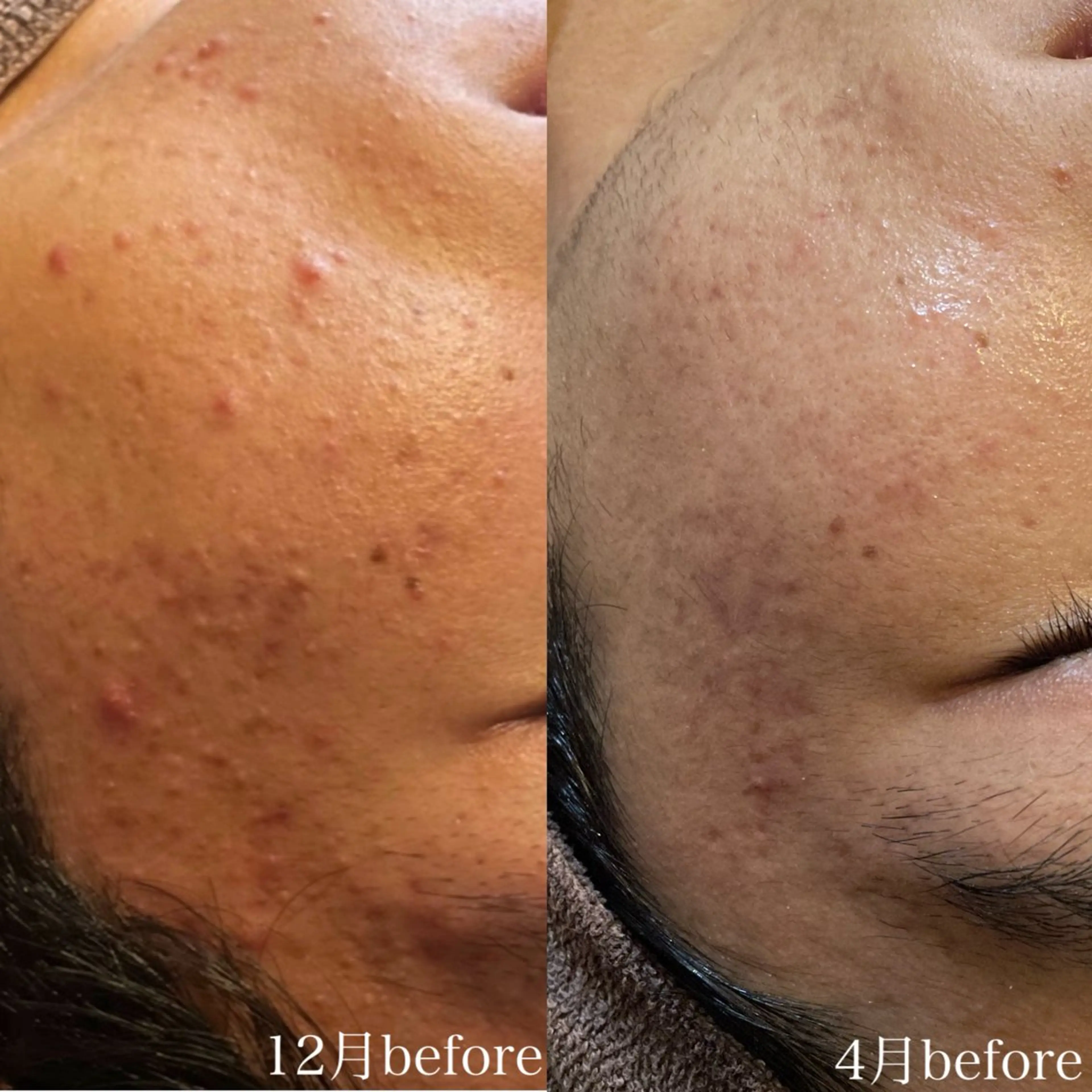 骨気&Relaxation vivian所属・VIVIAN 前田のエステ・リラクイメージ