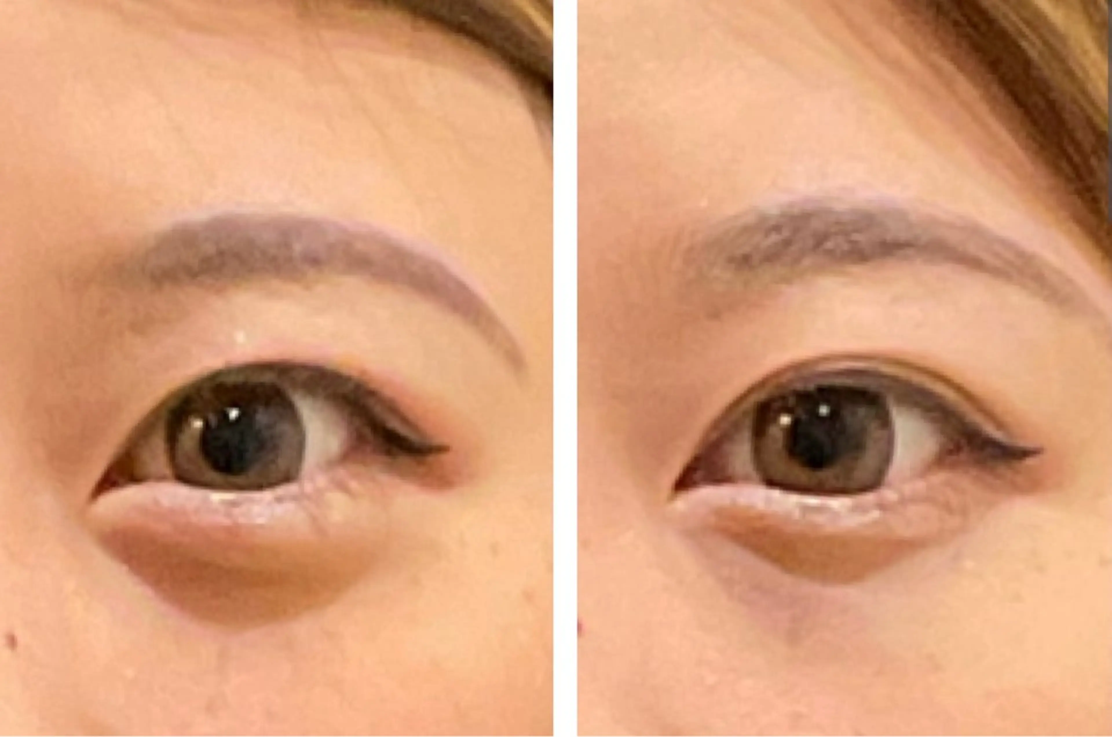 最速小顔・肌質管理 espoirマキのエステ・リラクイメージ