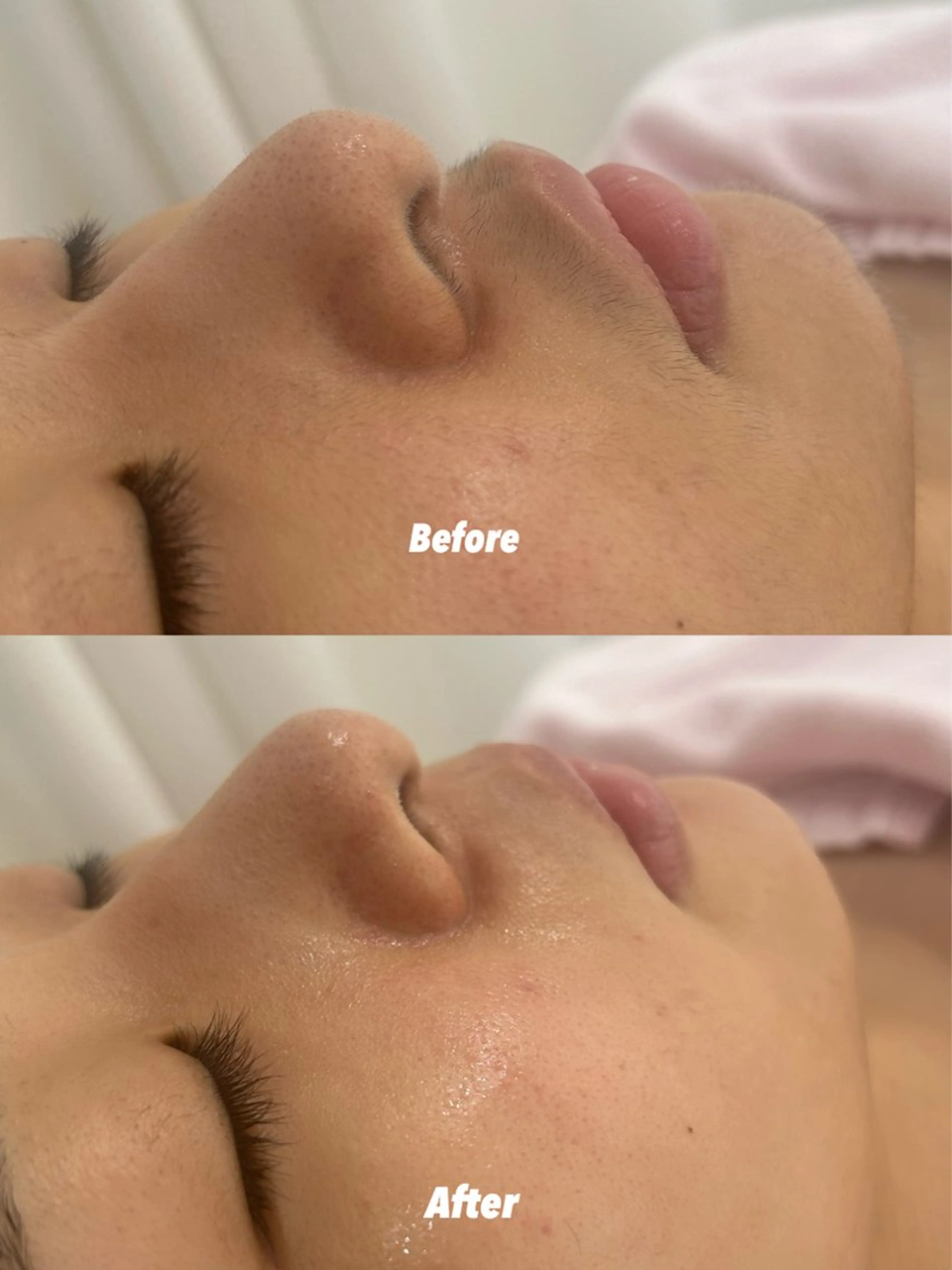 その他 🫧美しい素肌へ🫧 今成柚乃のその他イメージ