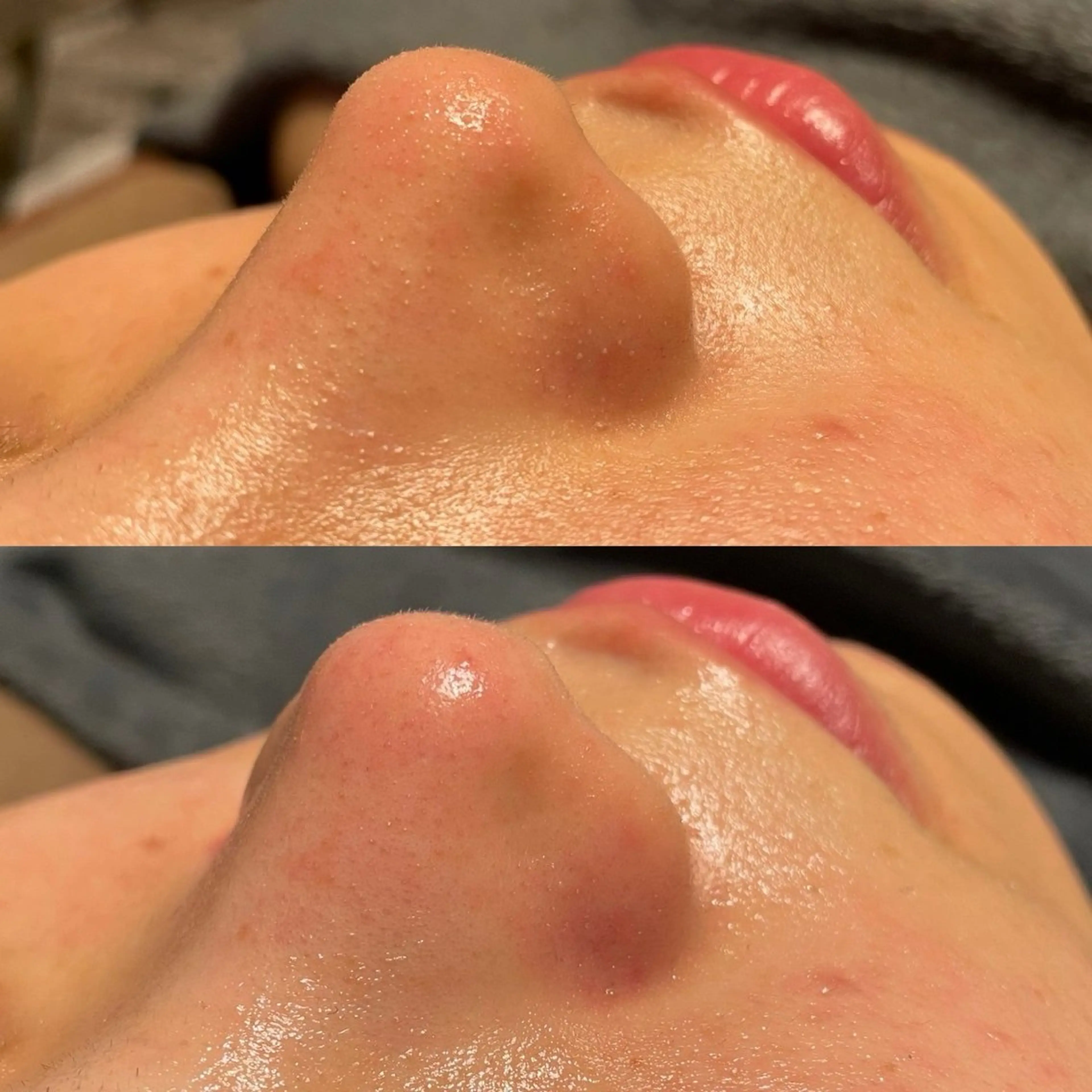 肌管理専門店Whitelabo堺東店所属・おだ あみのエステ・リラクイメージ