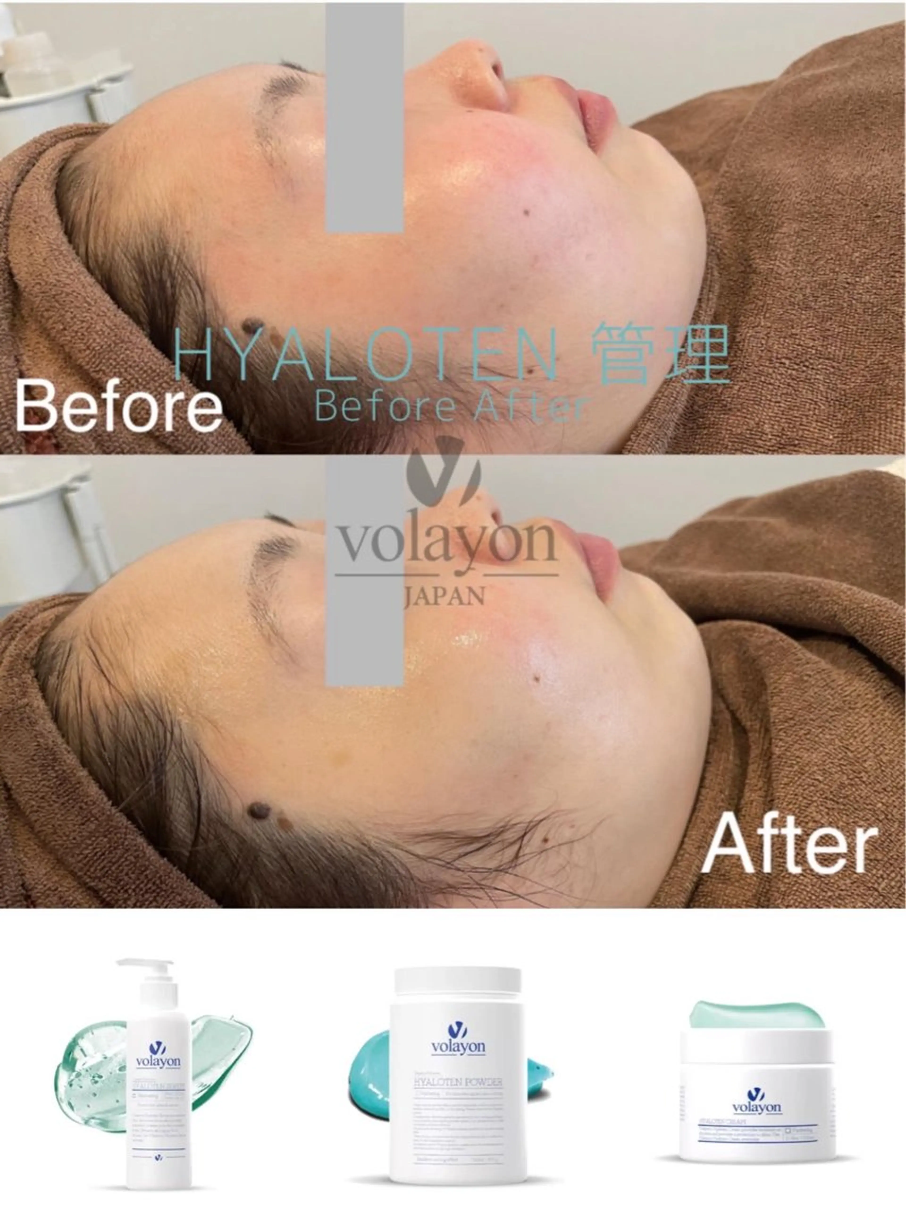 エステ ウプエステティック所属・韓国肌管理 ウプエステティックのエステ・リラクイメージ