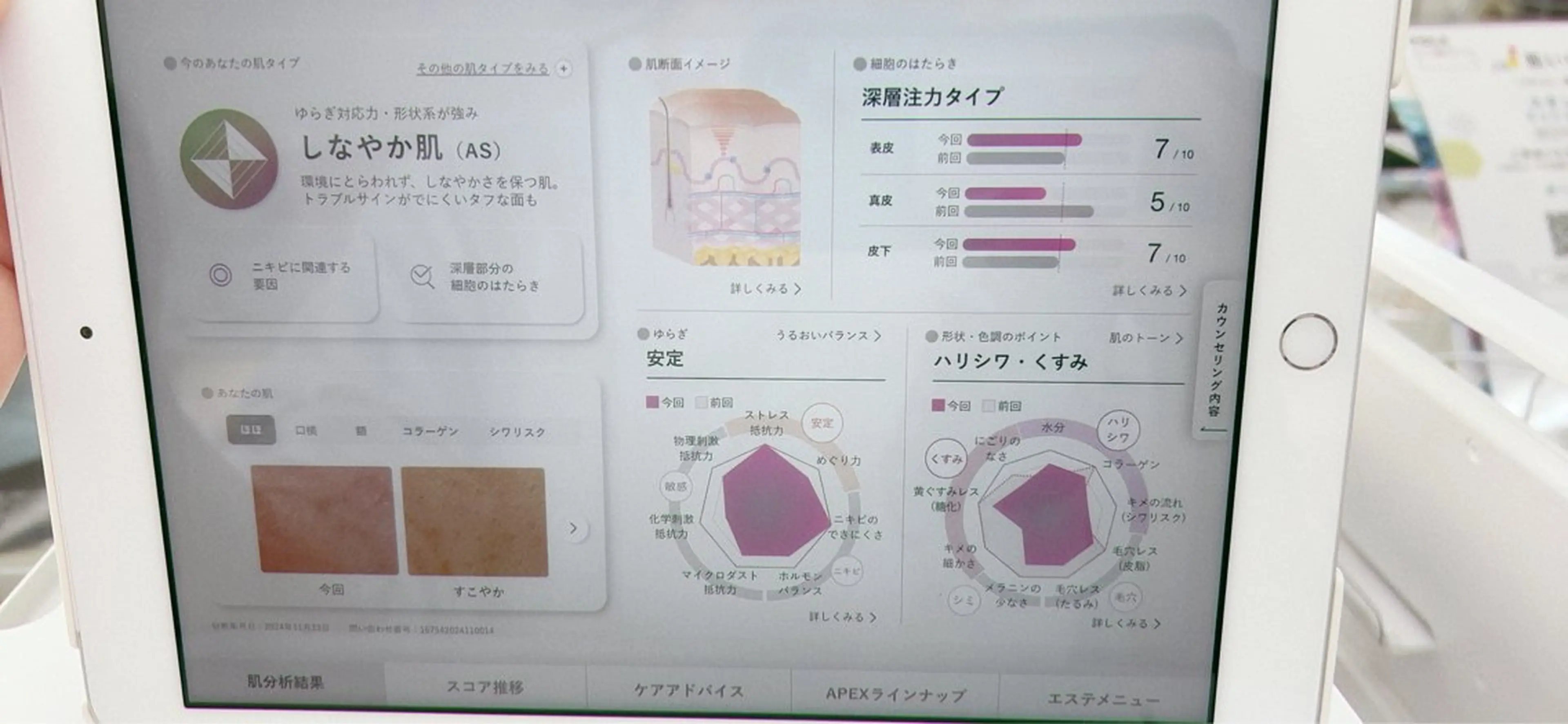 【新肌分析】あなたの肌タイプがわかる✨688万通りの中からあなたの肌に合わせたスキンケアがお試しできます♡〈メンズ🆗〉の写真