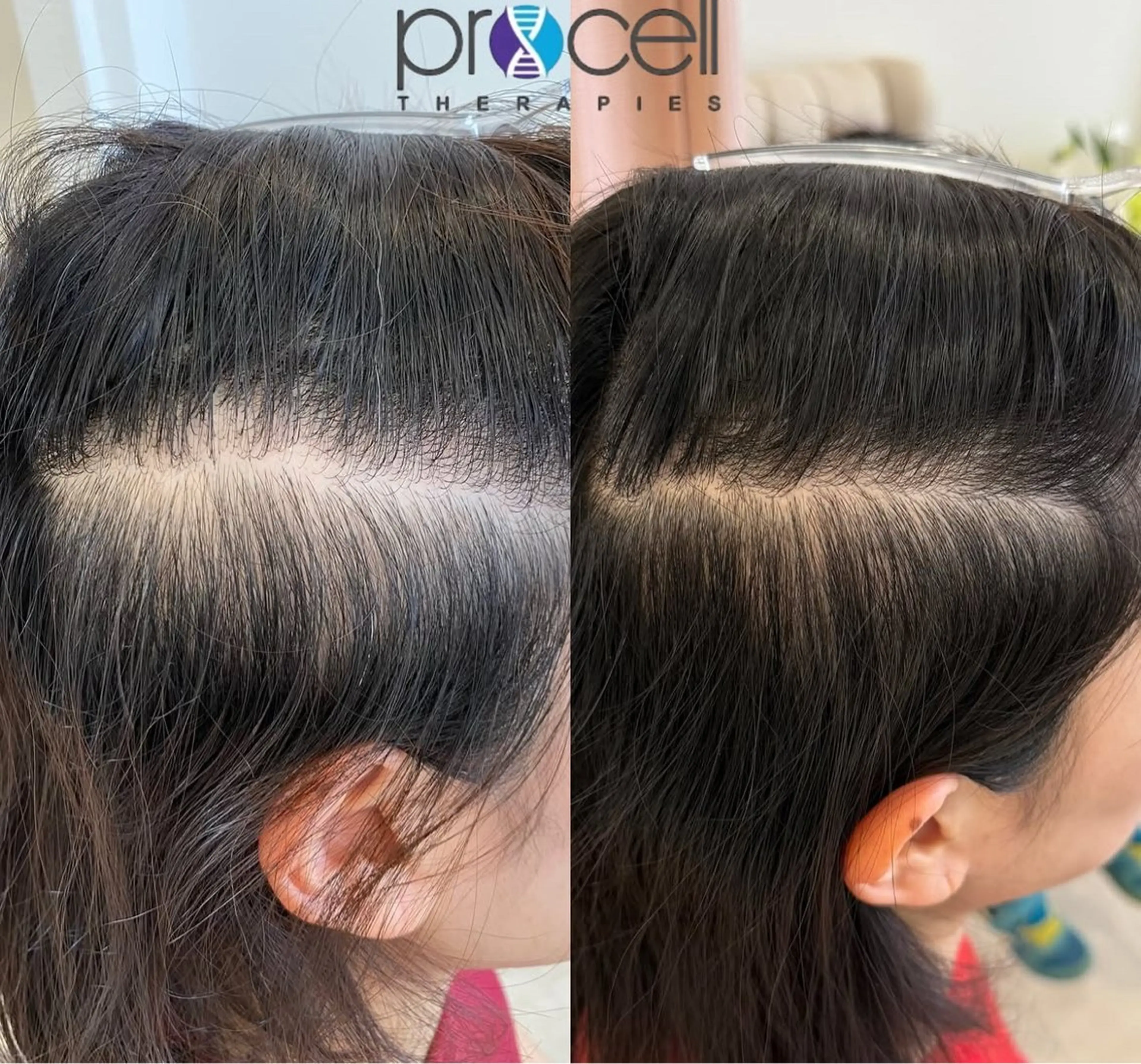 Blooming所属・LOUISE. ／肌質・頭皮のエステ・リラクイメージ