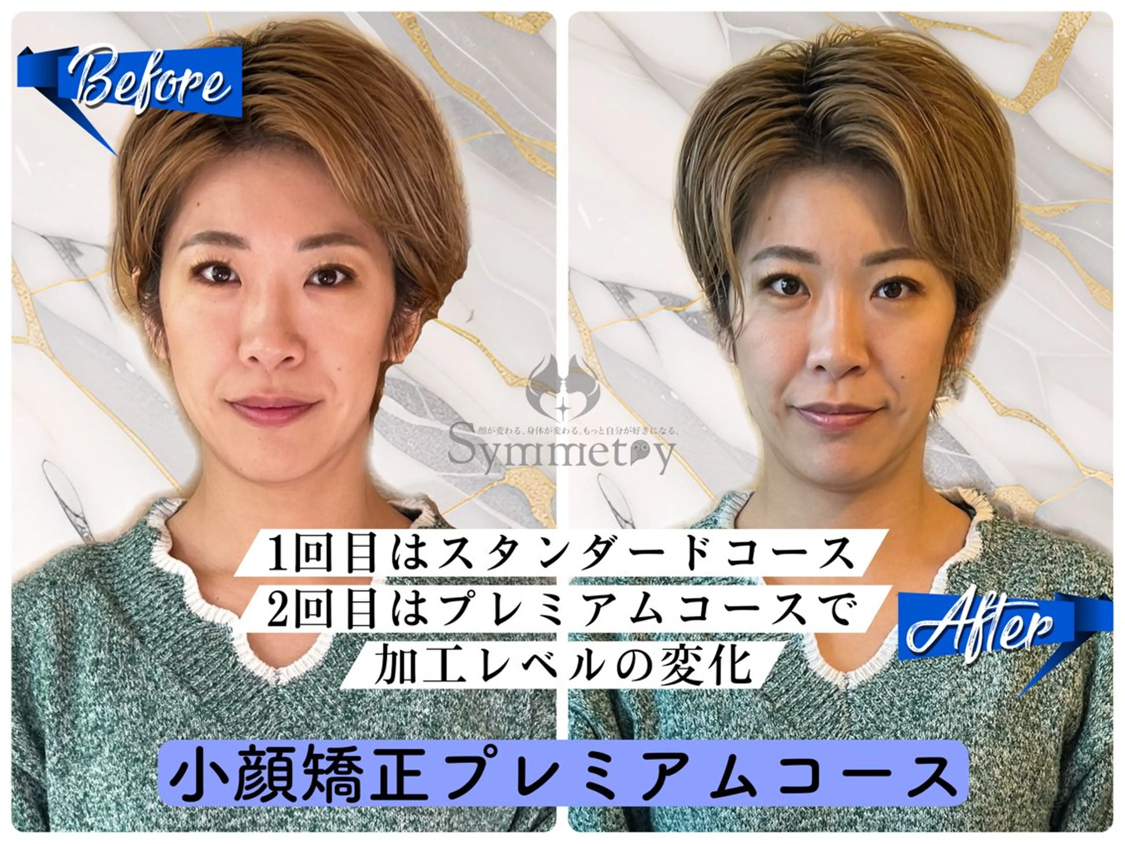 《小顔矯正プレミアムコース💎》全身小顔美矯正 120分 ¥24,200の写真