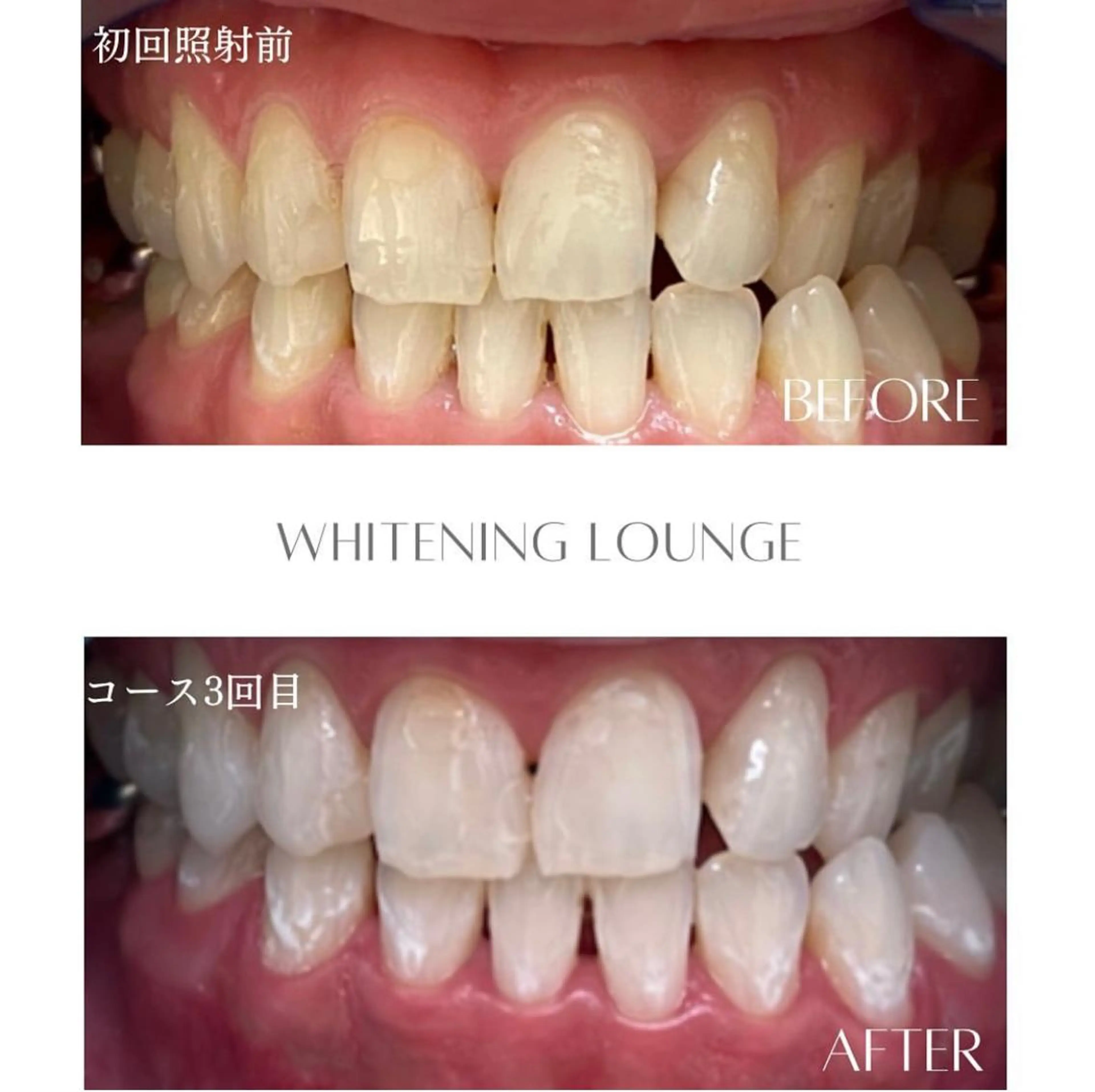 ホワイトニングラウンジ横須賀所属・ホワイトニング Lounge横須賀のその他イメージ