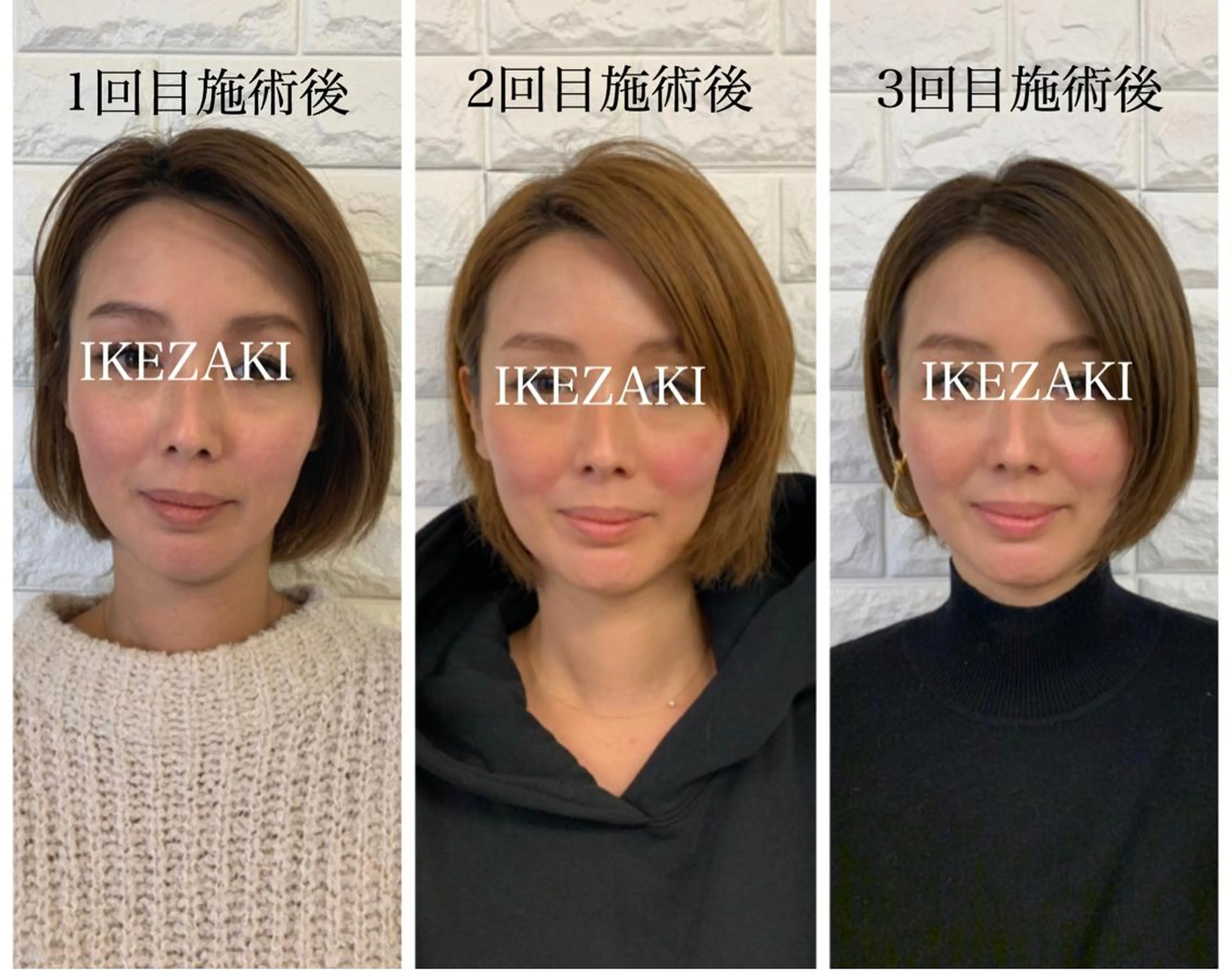 美容鍼 IKEZAKIのエステ・リラクイメージ