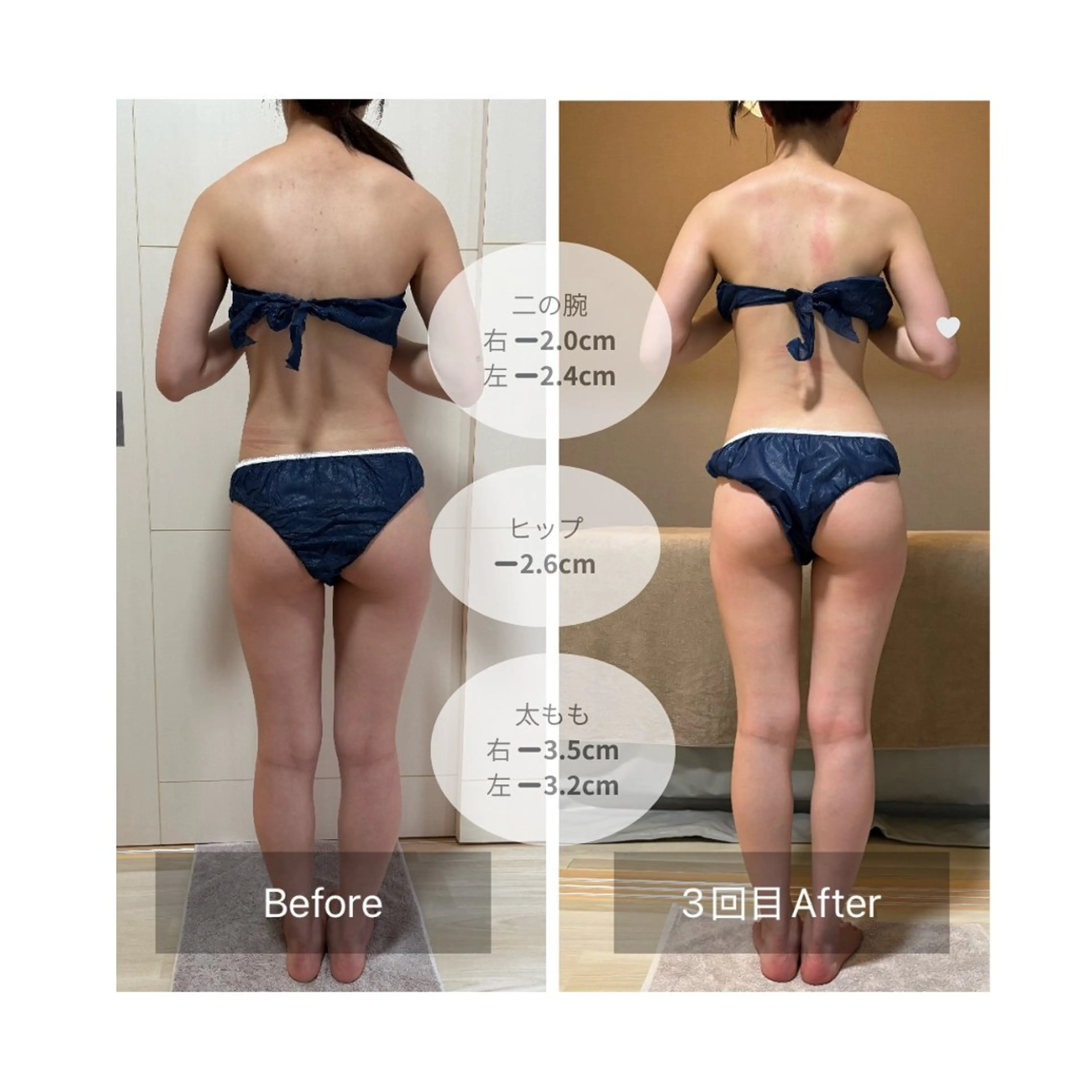 《仮予約》下半身45分｜美脚＆ヒップアップ集中ケア！ヒップラインをキュッと上向きに♪むくみや脚のだるさが気になる方にも◎の写真