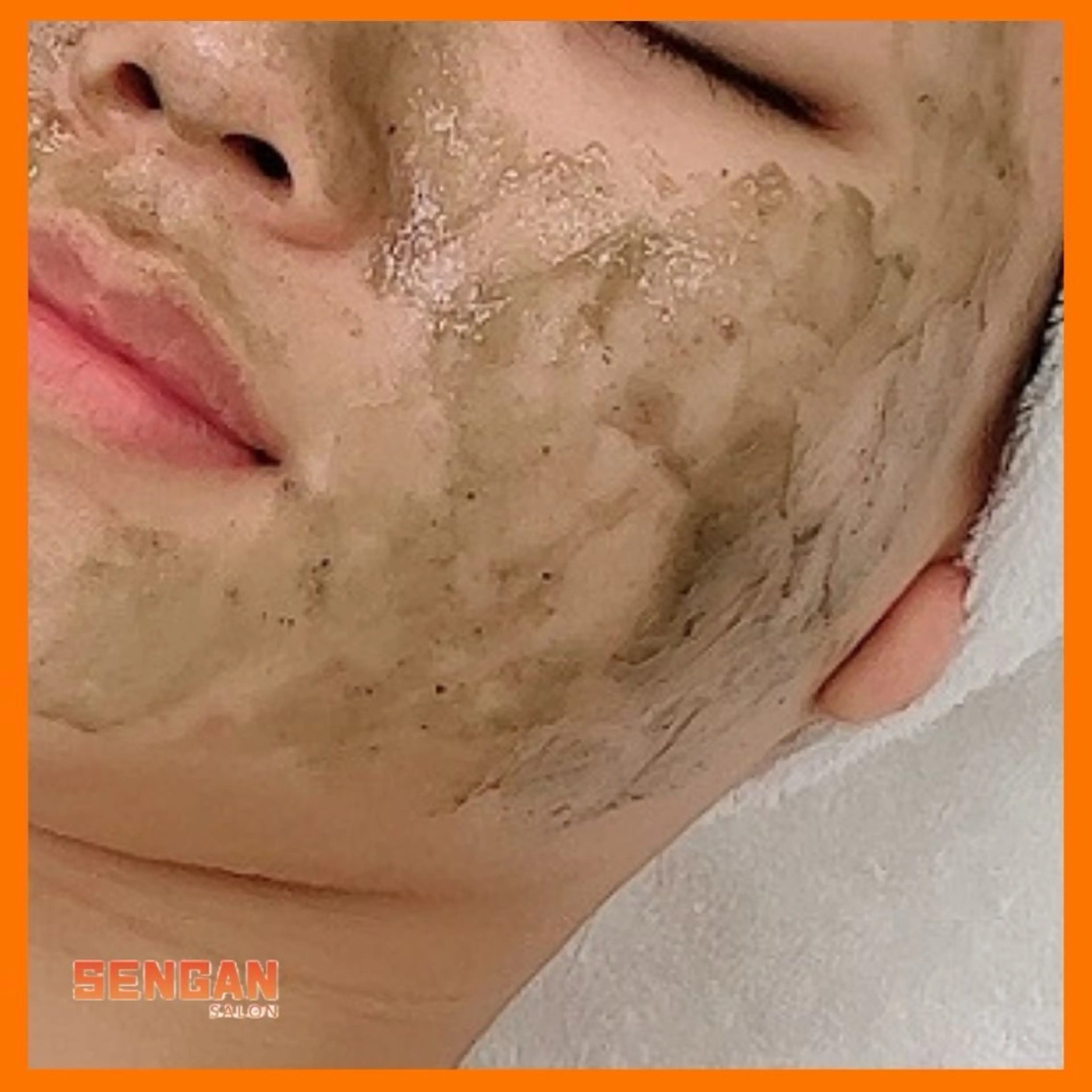 ★18 ハーブピーリング(剥離)Lv.2　90分 28000円→75％offの写真